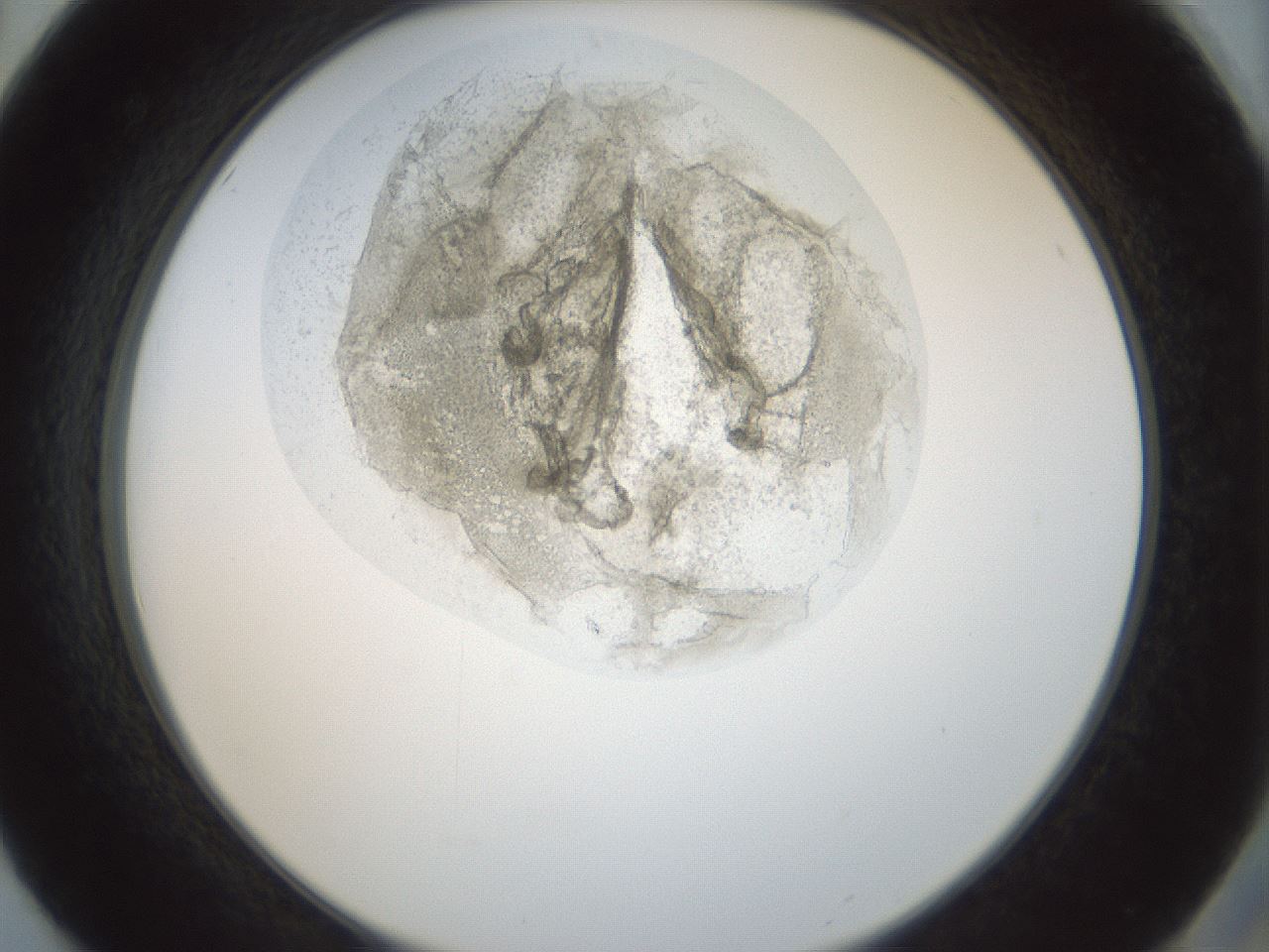 folderID155_plateID1155_batchID3205_wellNum50_profileID1_d2_r62530_ef.jpg