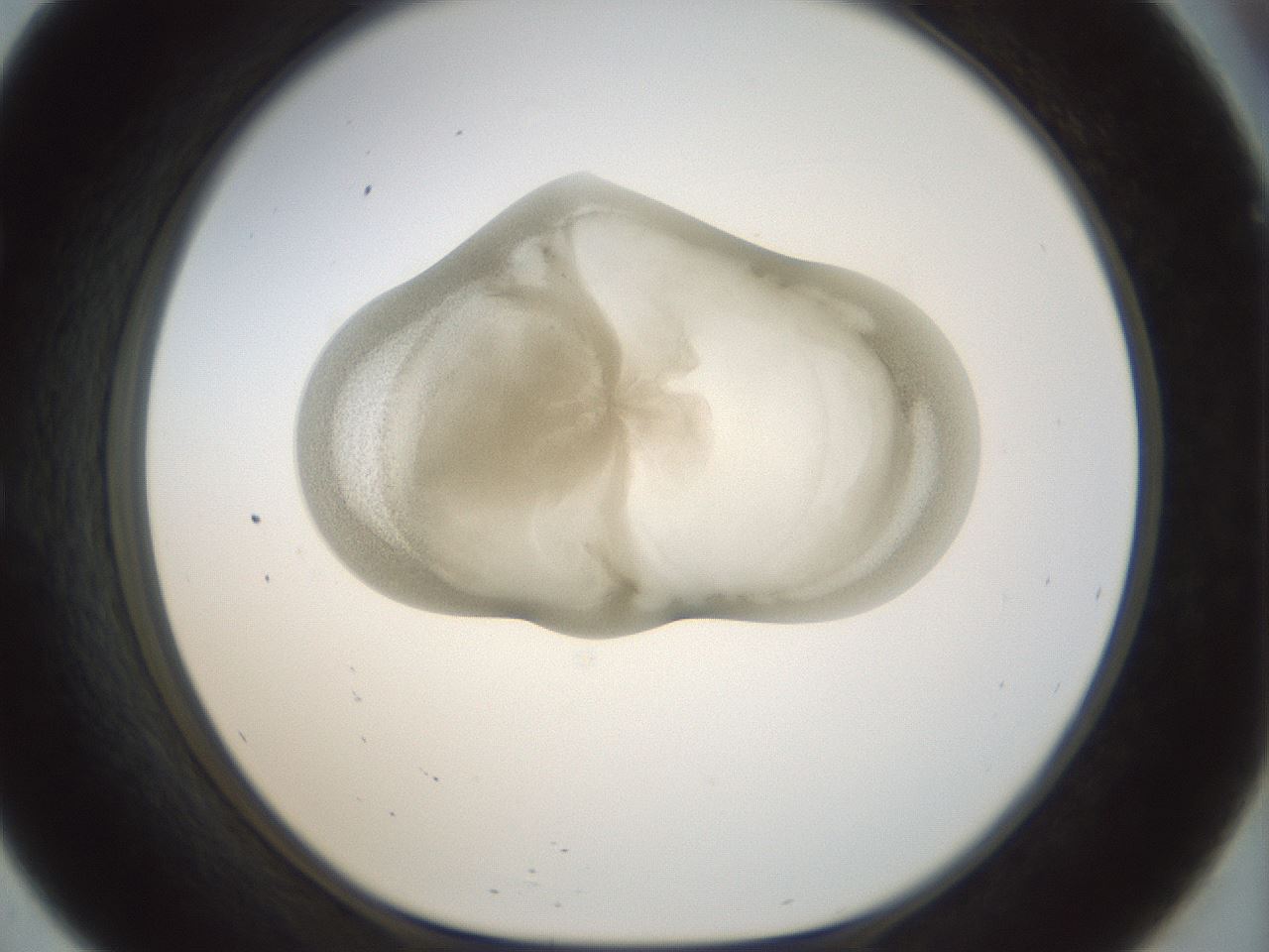 folderID155_plateID1155_batchID3205_wellNum57_profileID1_d1_r62543_ef.jpg
