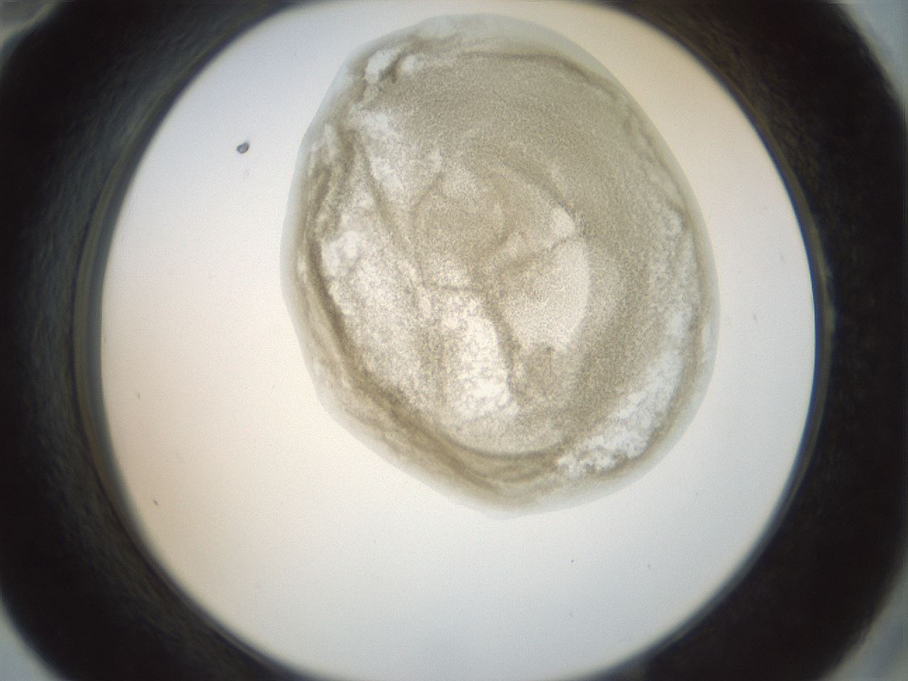 folderID155_plateID1155_batchID3205_wellNum58_profileID1_d2_r62546_ef.jpg