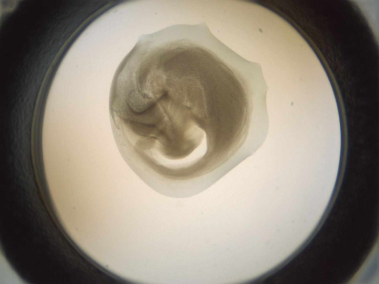 folderID155_plateID1155_batchID3205_wellNum59_profileID1_d2_r62548_ef.jpg