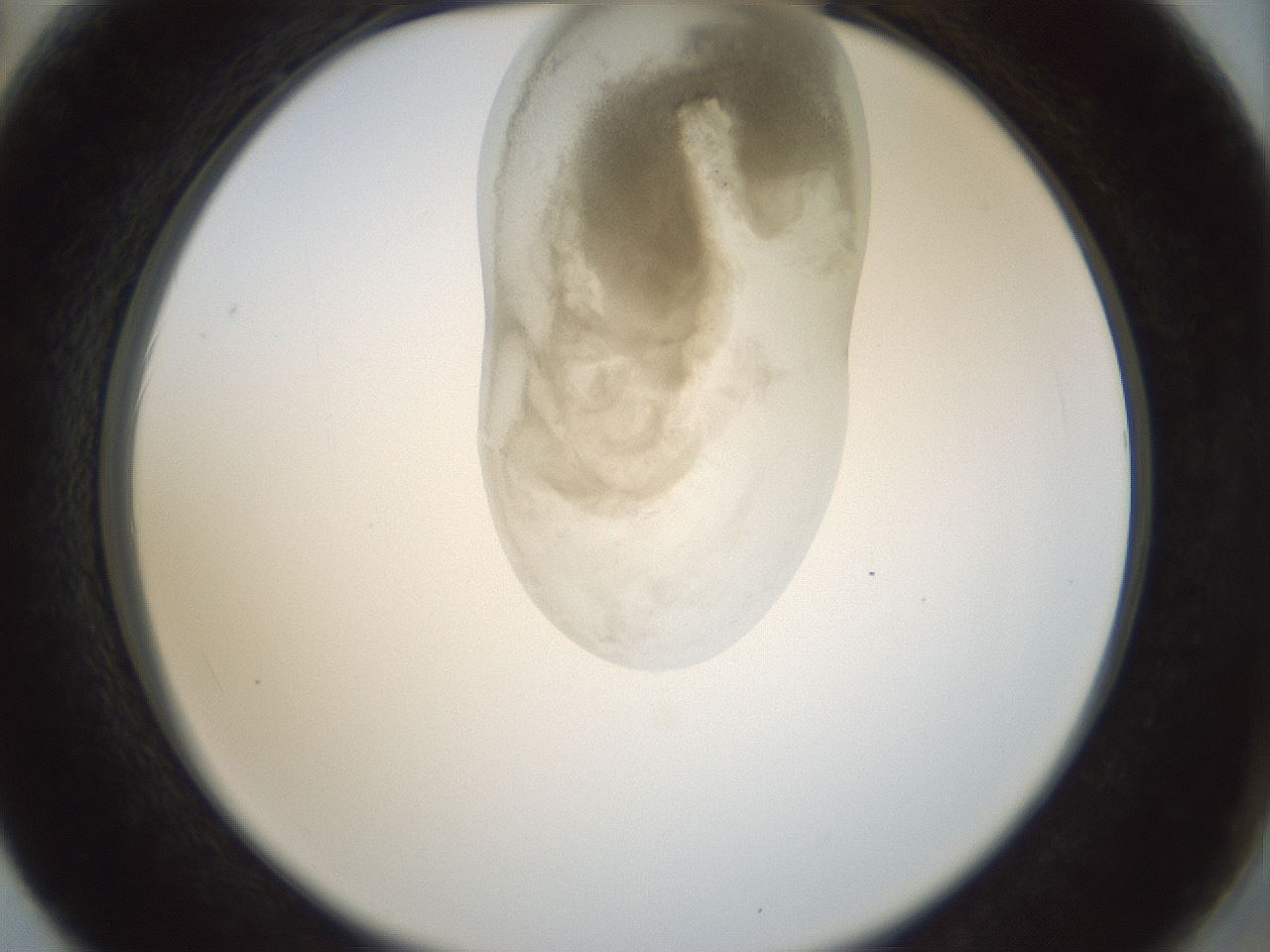 folderID155_plateID1155_batchID3205_wellNum62_profileID1_d2_r62554_ef.jpg