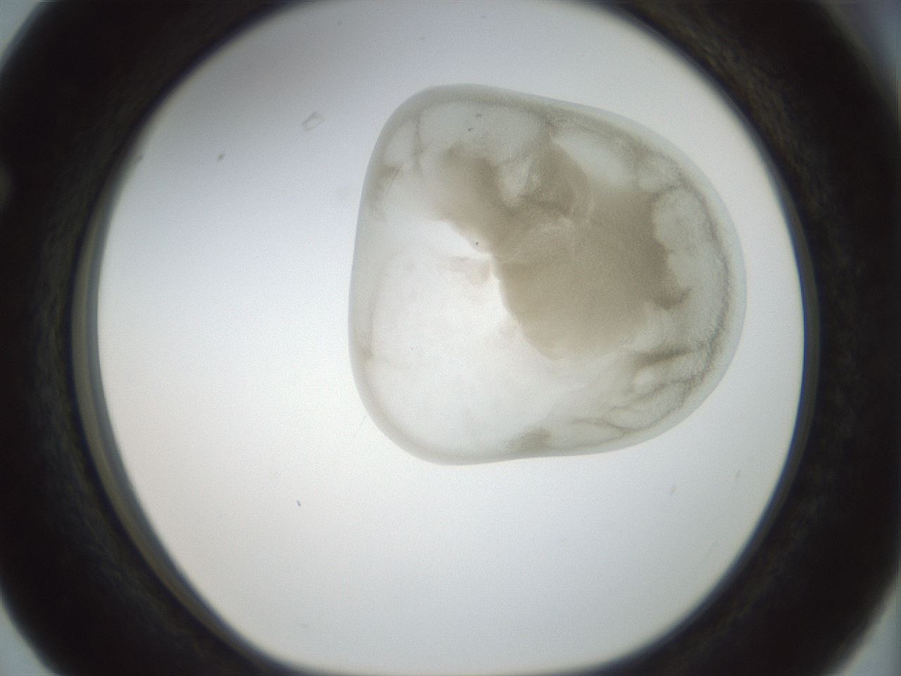 folderID155_plateID1155_batchID3205_wellNum63_profileID1_d1_r62555_ef.jpg
