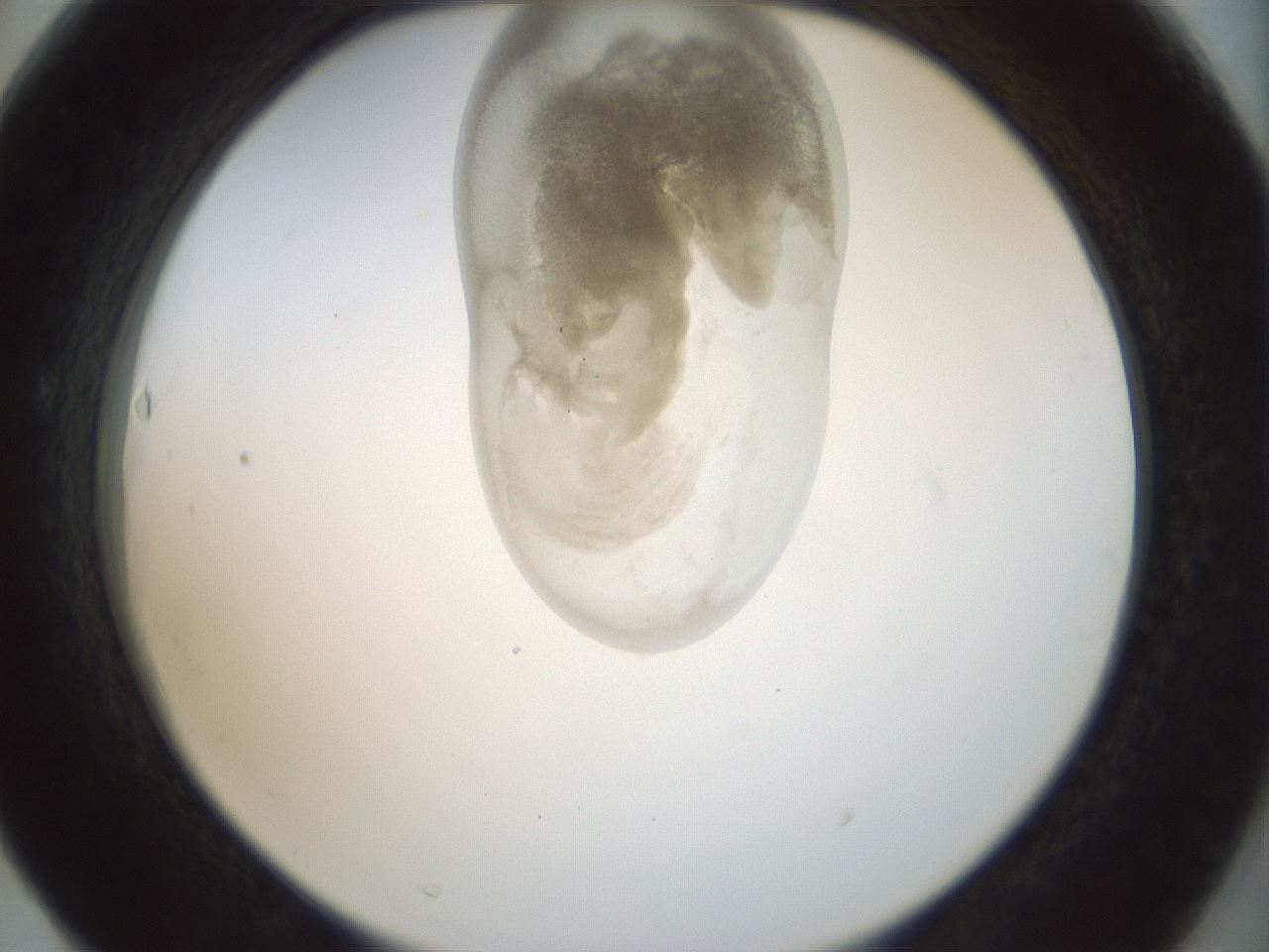 folderID155_plateID1155_batchID3205_wellNum63_profileID1_d2_r62556_ef.jpg
