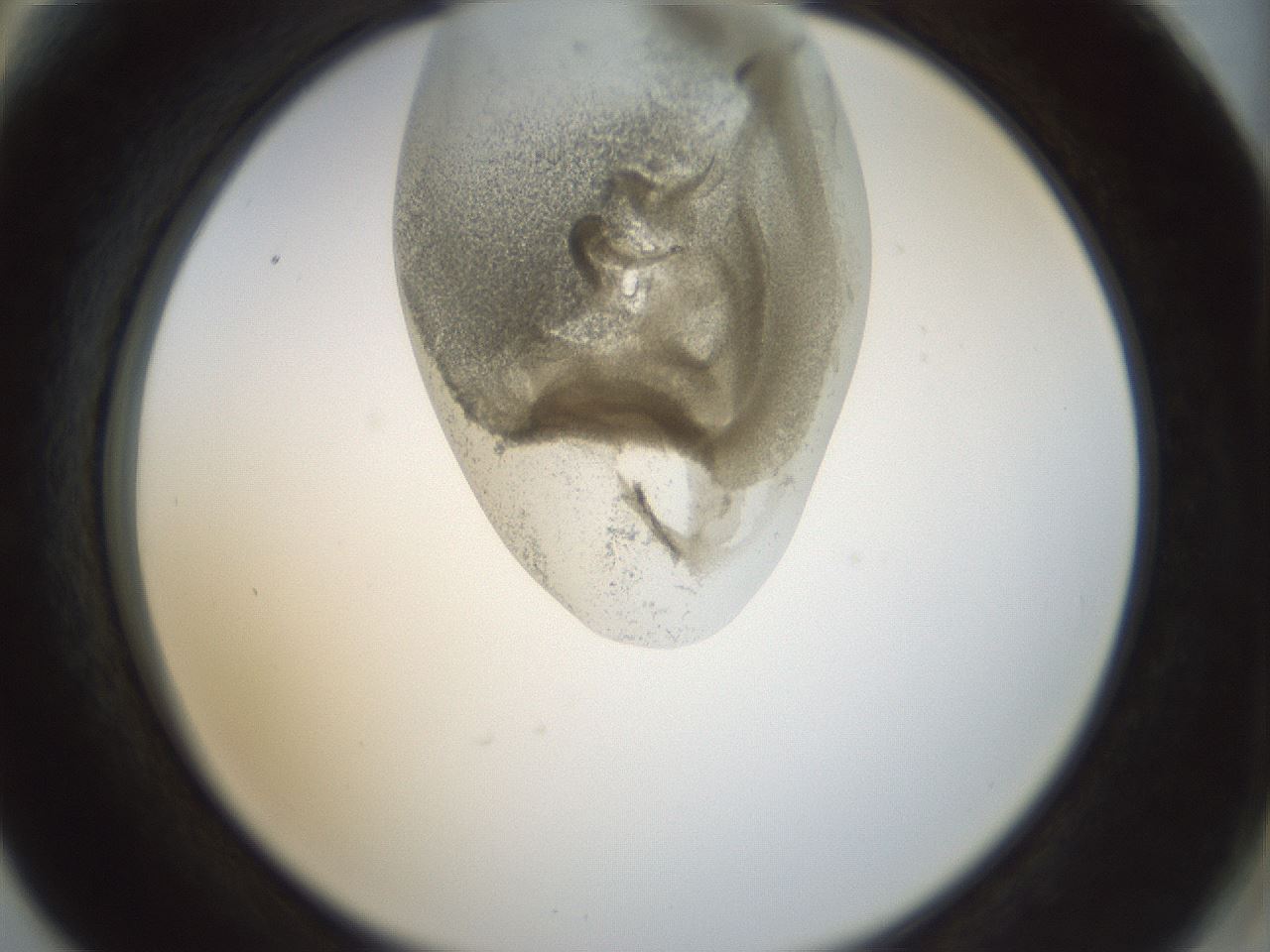 folderID155_plateID1155_batchID3205_wellNum66_profileID1_d2_r62562_ef.jpg