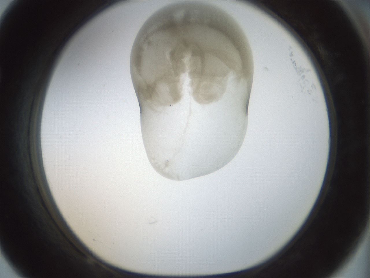 folderID155_plateID1155_batchID3205_wellNum68_profileID1_d1_r62565_ef.jpg