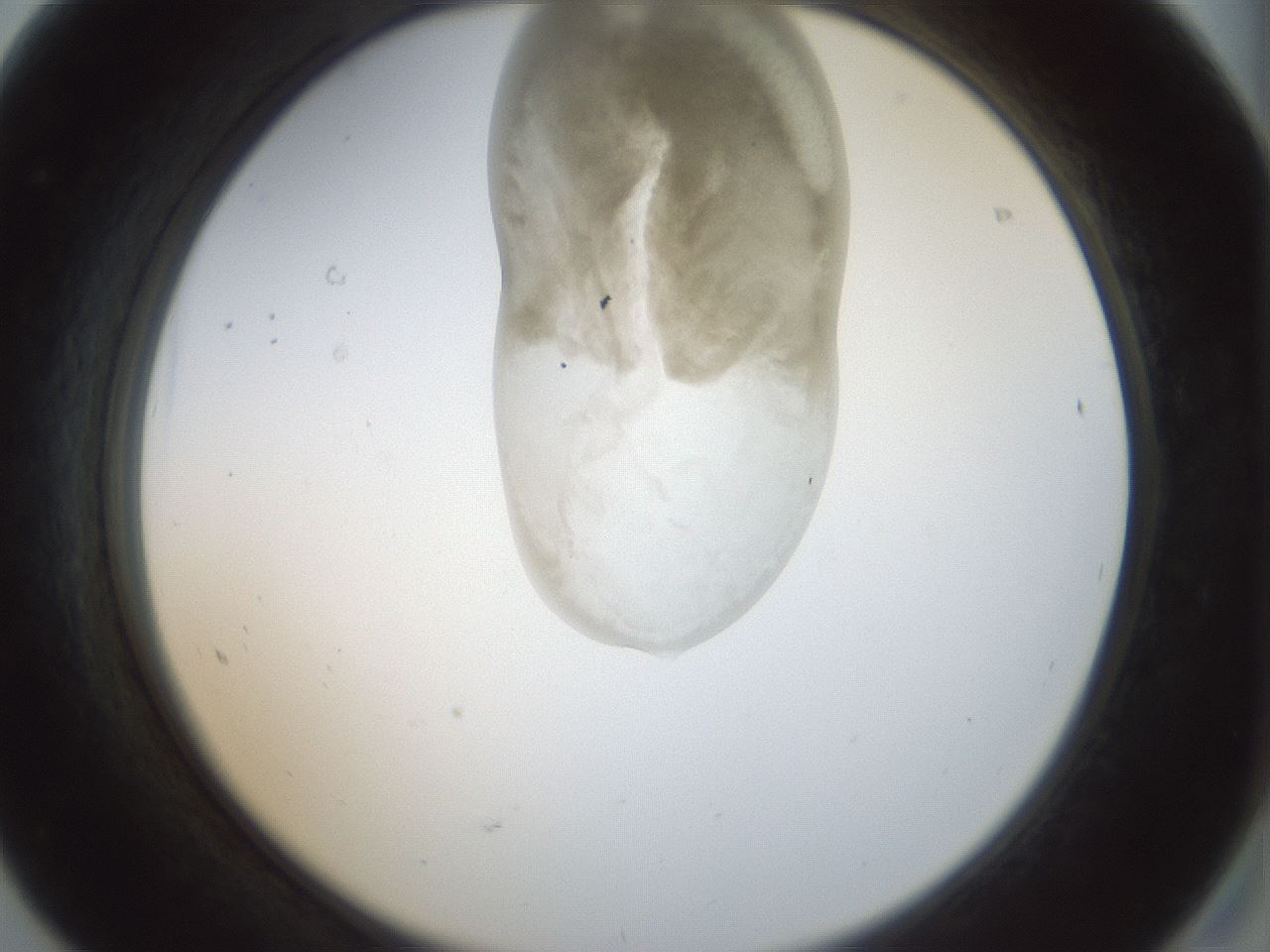 folderID155_plateID1155_batchID3205_wellNum68_profileID1_d2_r62566_ef.jpg