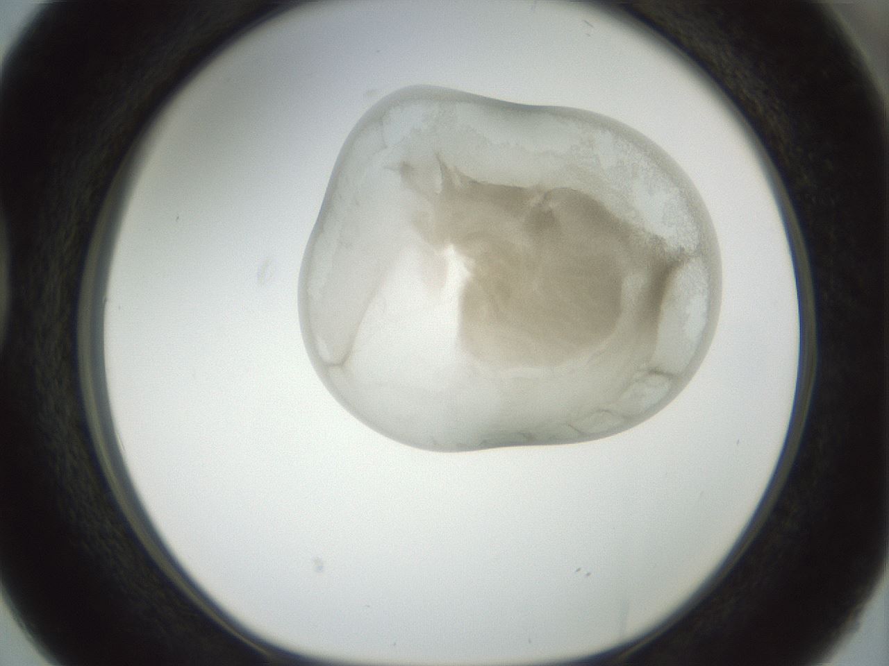 folderID155_plateID1155_batchID3205_wellNum38_profileID1_d1_r62505_ef.jpg