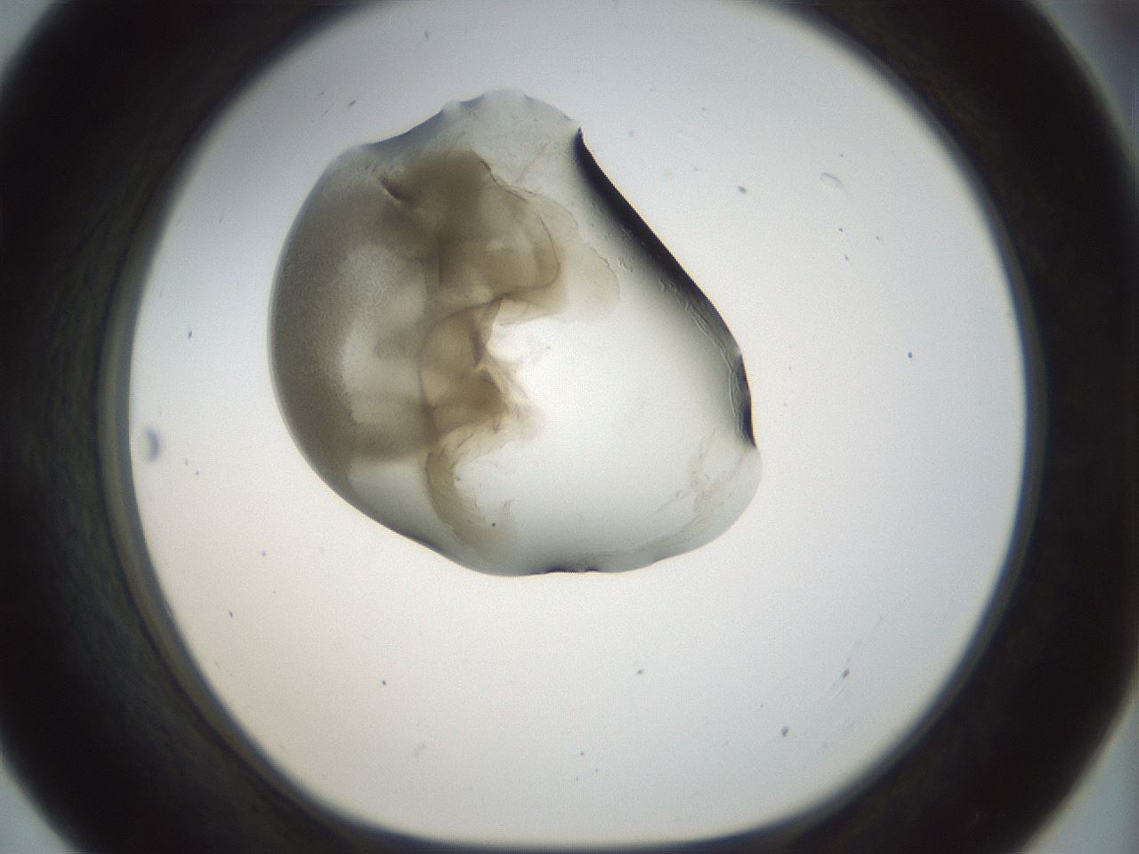 folderID155_plateID1155_batchID3205_wellNum55_profileID1_d1_r62539_ef.jpg