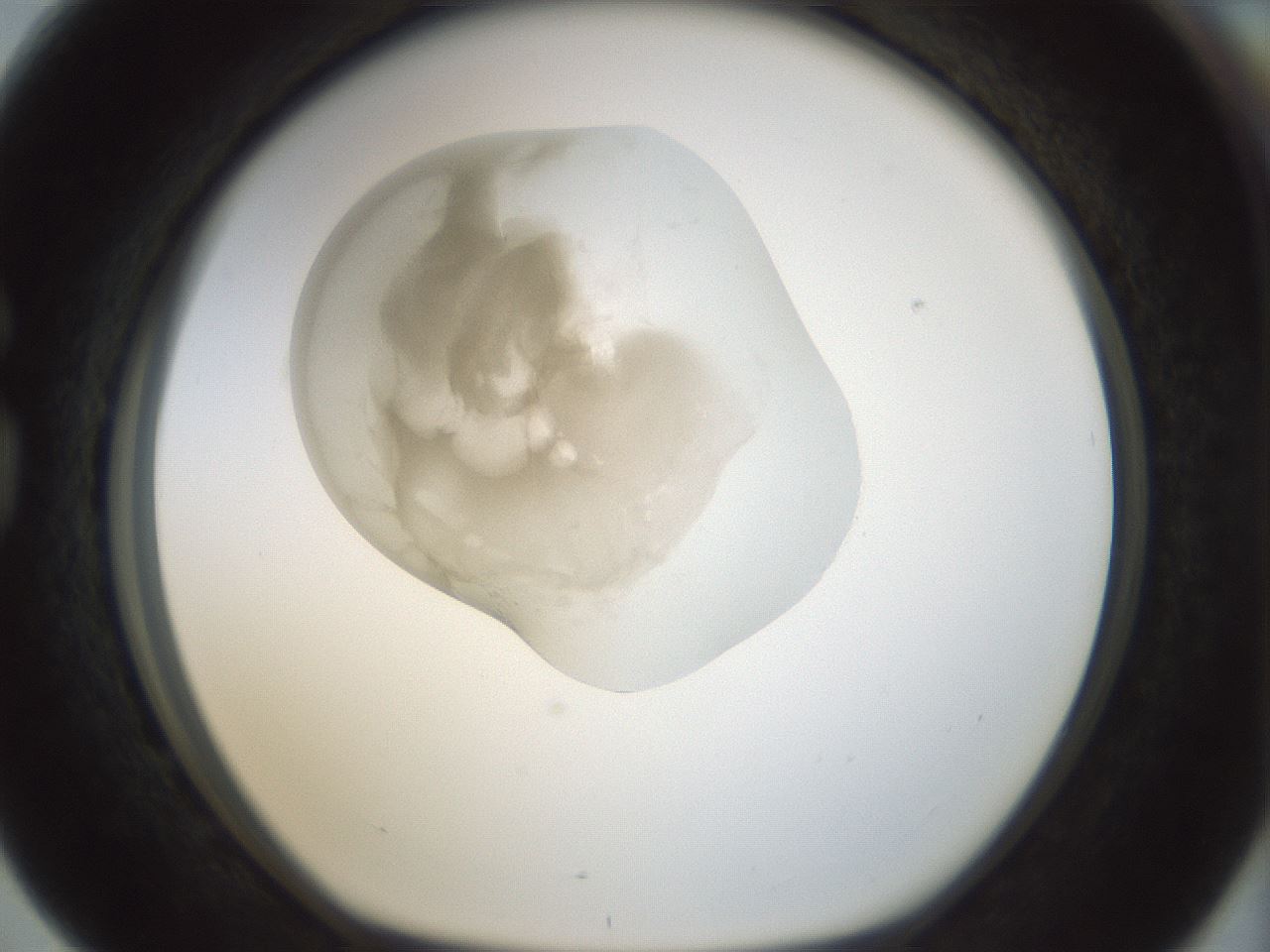 folderID155_plateID1155_batchID3205_wellNum76_profileID1_d1_r62581_ef.jpg
