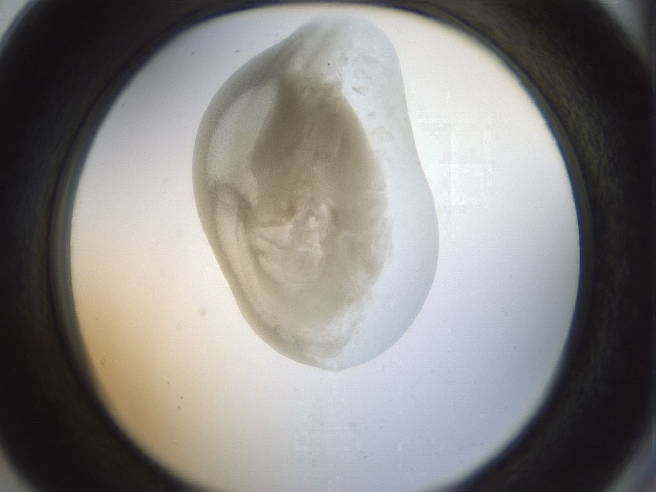 folderID155_plateID1155_batchID3205_wellNum80_profileID1_d2_r62590_ef.jpg
