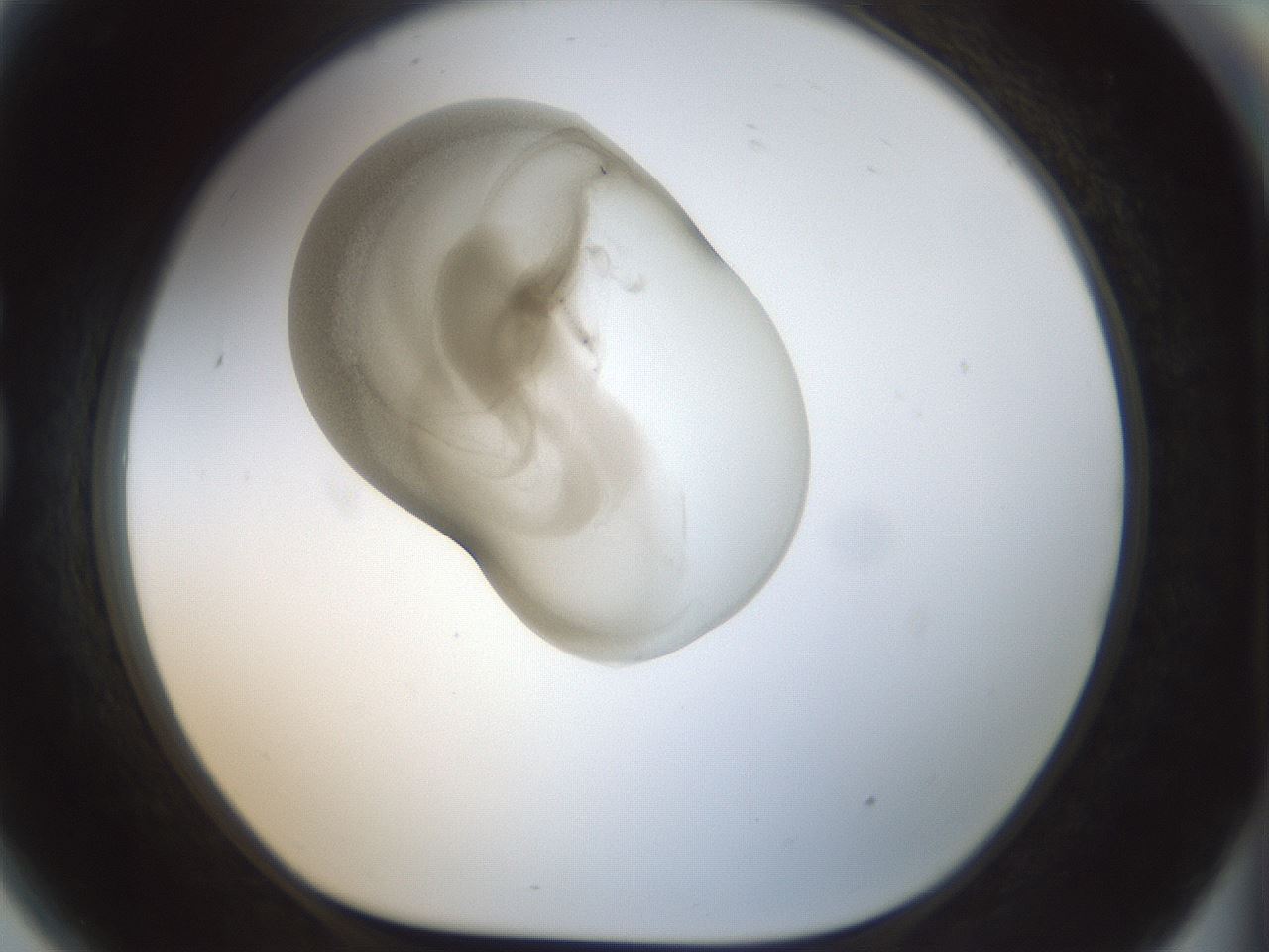 folderID155_plateID1155_batchID3205_wellNum81_profileID1_d1_r62591_ef.jpg