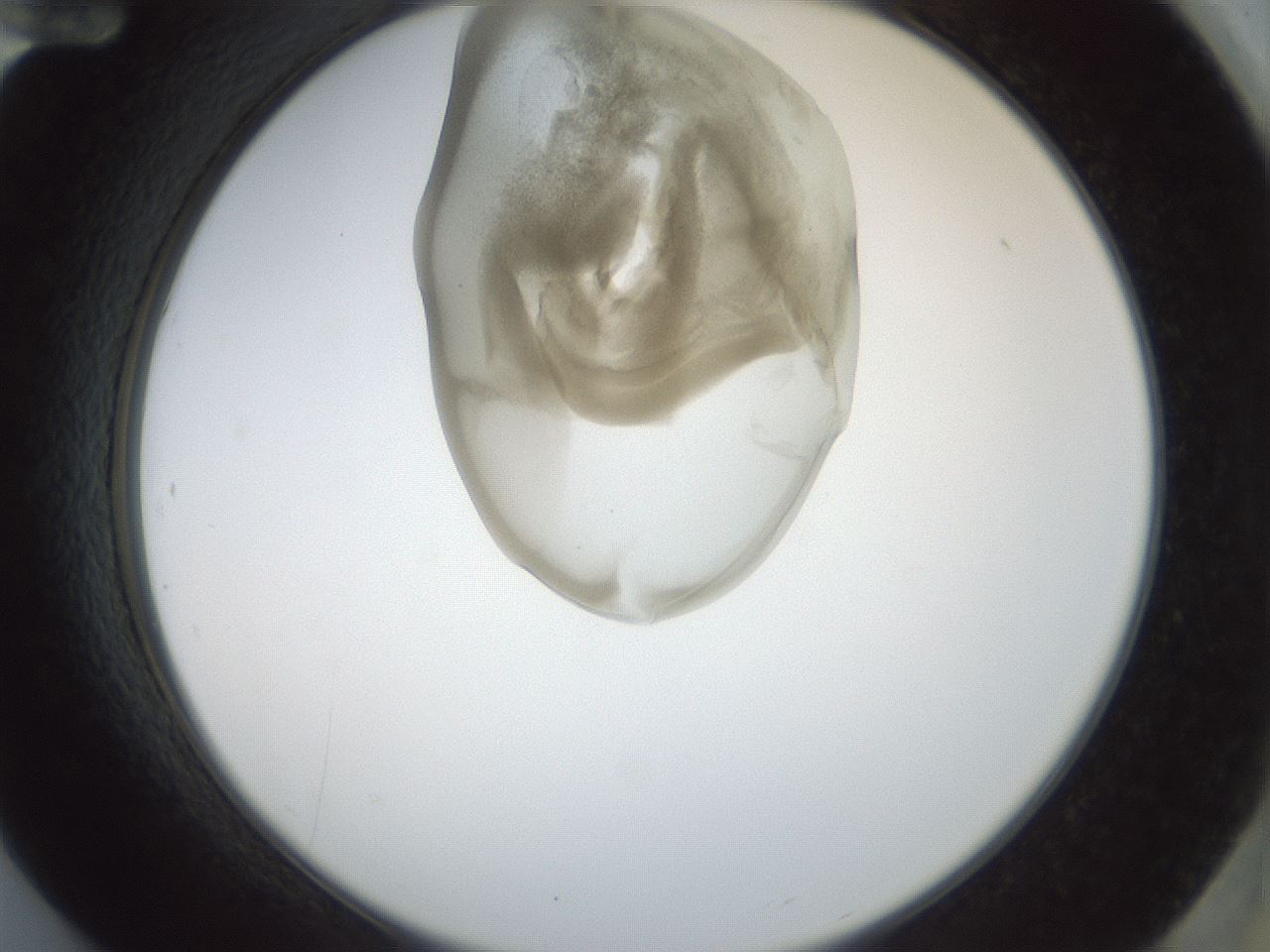 folderID155_plateID1155_batchID3205_wellNum84_profileID1_d2_r62598_ef.jpg