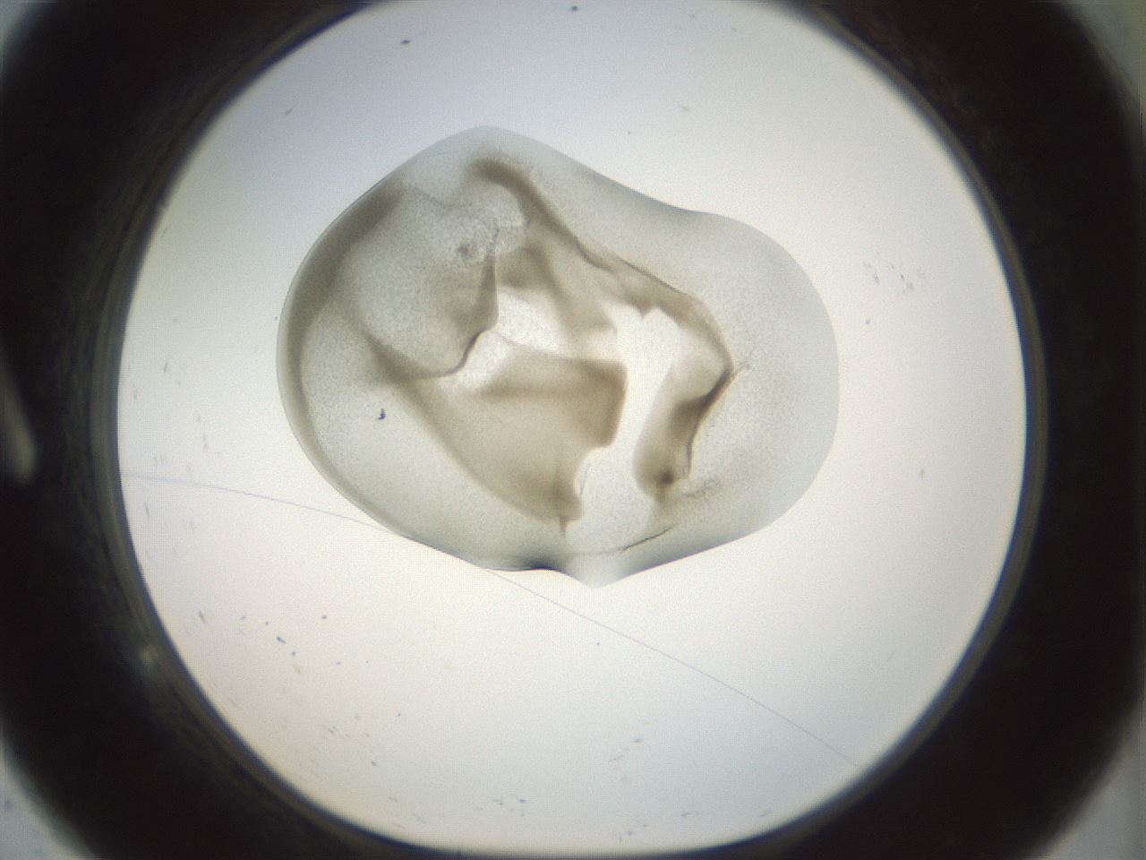 folderID155_plateID1155_batchID3205_wellNum9_profileID1_d1_r62447_ef.jpg