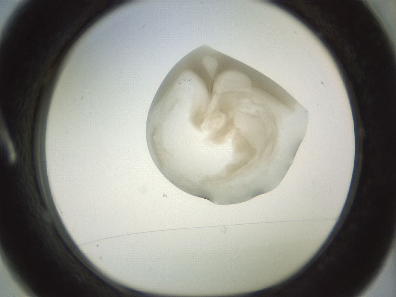 folderID156_plateID1156_batchID3128_wellNum1_profileID1_d1_r63583_ef.jpg