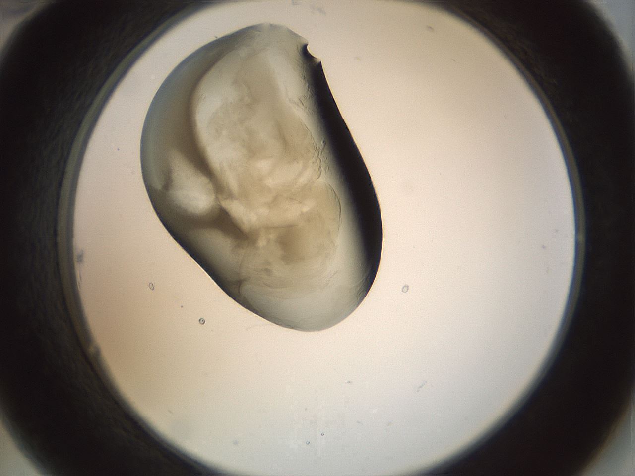 folderID156_plateID1156_batchID3128_wellNum22_profileID1_d2_r63626_ef.jpg