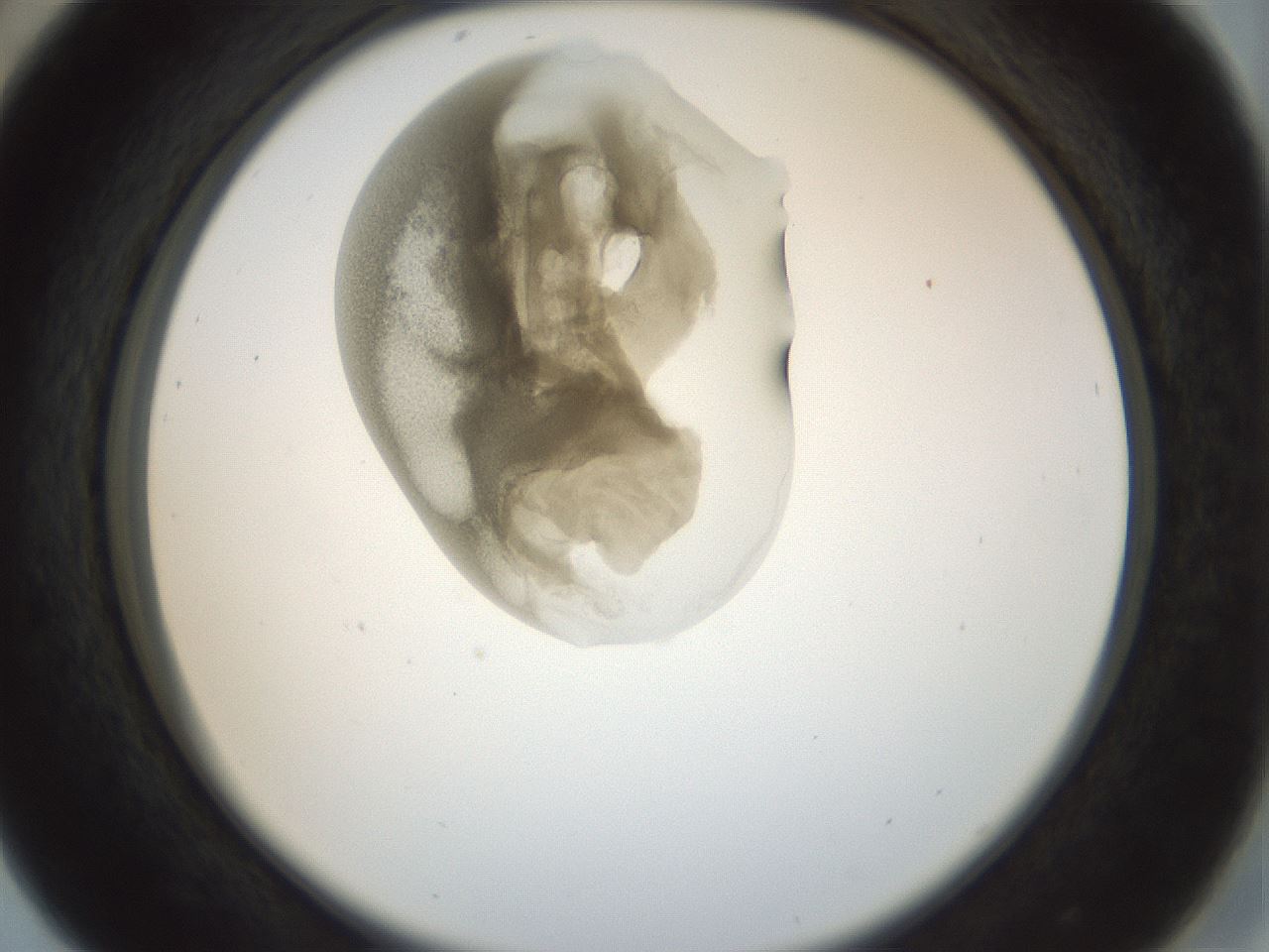 folderID156_plateID1156_batchID3128_wellNum29_profileID1_d2_r63640_ef.jpg