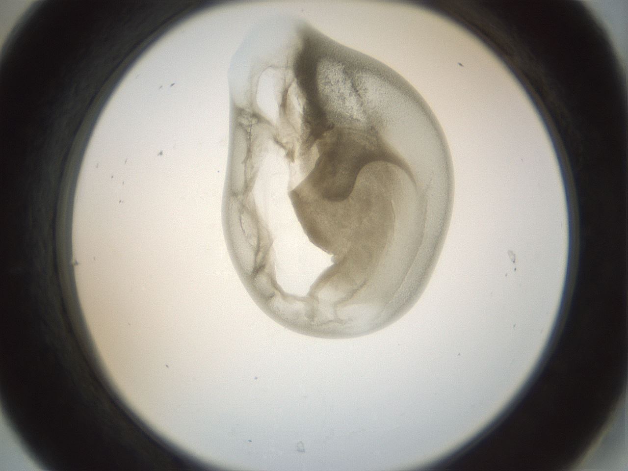 folderID156_plateID1156_batchID3128_wellNum31_profileID1_d2_r63644_ef.jpg