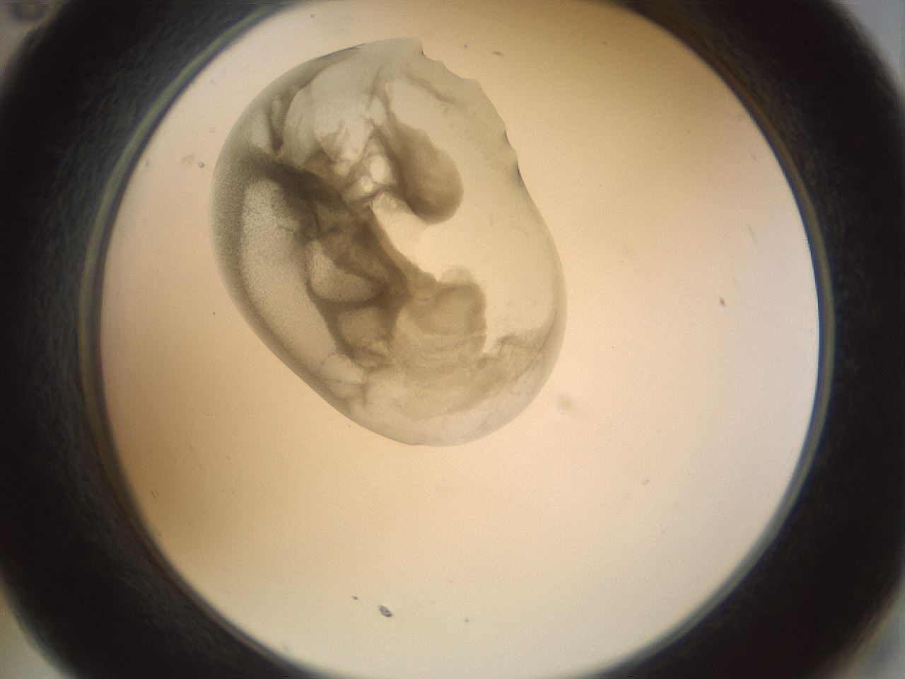 folderID156_plateID1156_batchID3128_wellNum35_profileID1_d2_r63652_ef.jpg
