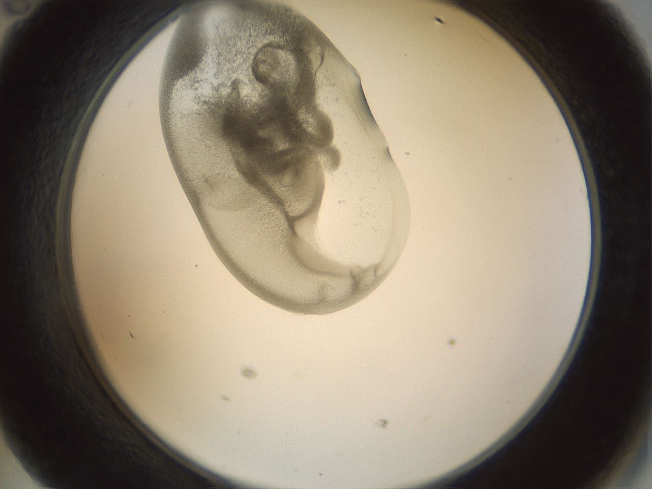 folderID156_plateID1156_batchID3128_wellNum47_profileID1_d2_r63676_ef.jpg