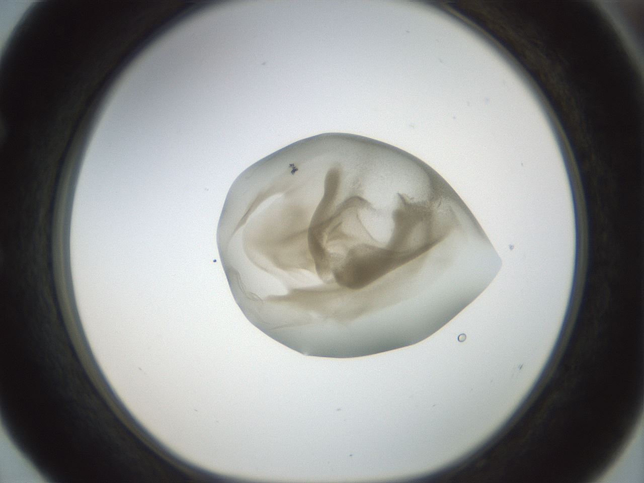 folderID156_plateID1156_batchID3128_wellNum52_profileID1_d1_r63685_ef.jpg