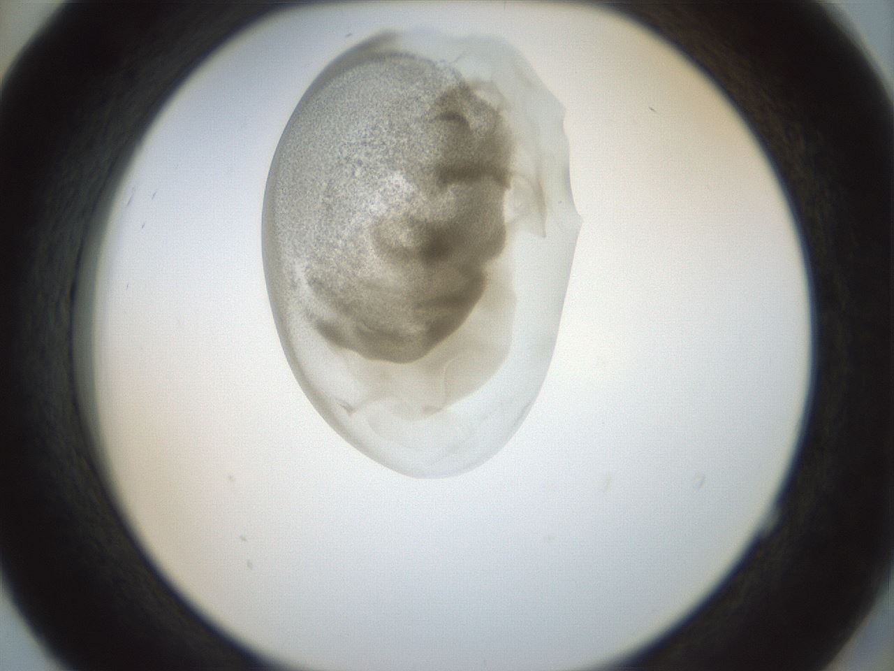 folderID156_plateID1156_batchID3128_wellNum52_profileID1_d2_r63686_ef.jpg