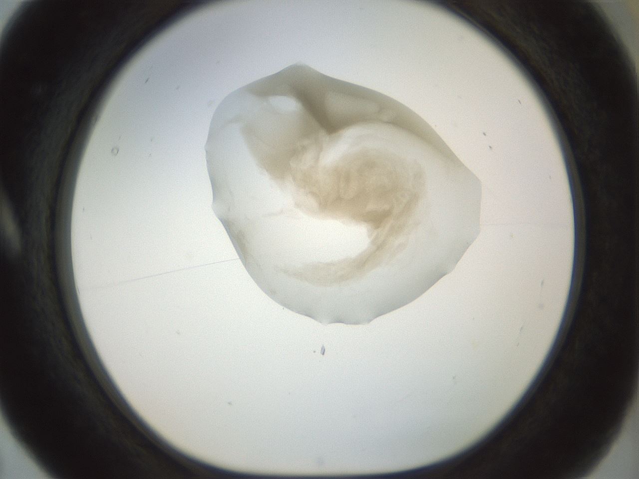 folderID156_plateID1156_batchID3128_wellNum5_profileID1_d1_r63591_ef.jpg
