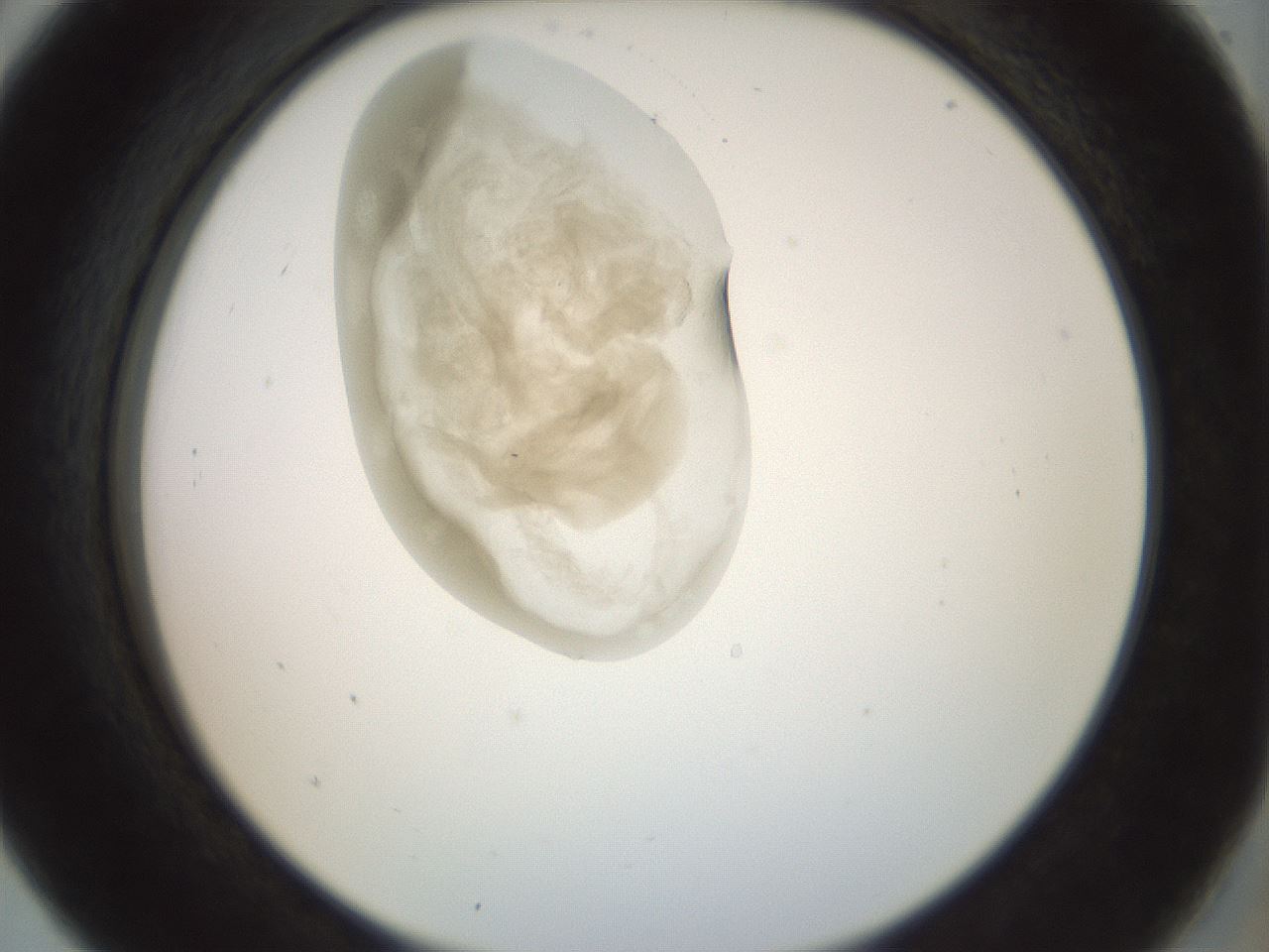 folderID156_plateID1156_batchID3128_wellNum5_profileID1_d2_r63592_ef.jpg