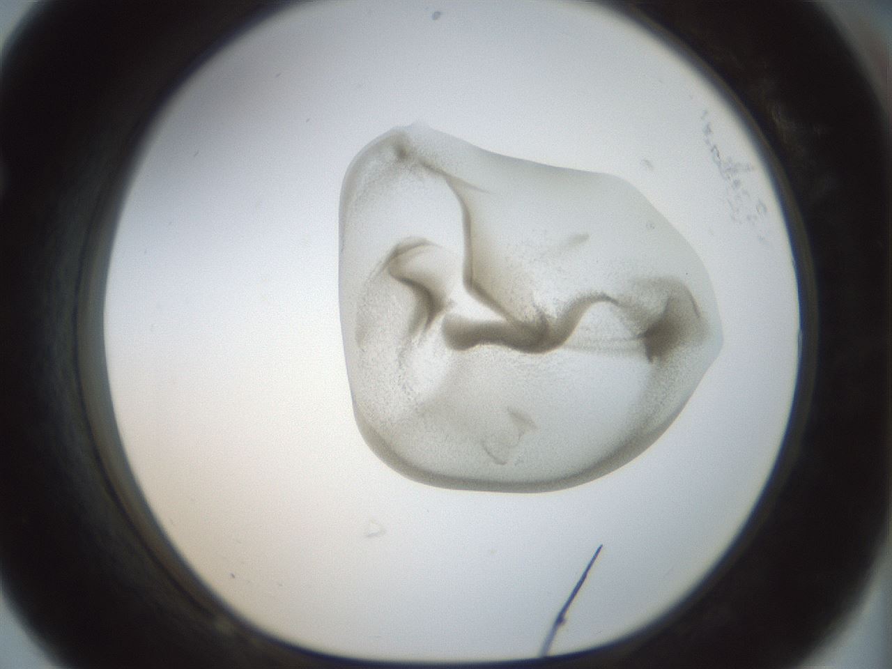folderID156_plateID1156_batchID3128_wellNum68_profileID1_d1_r63717_ef.jpg