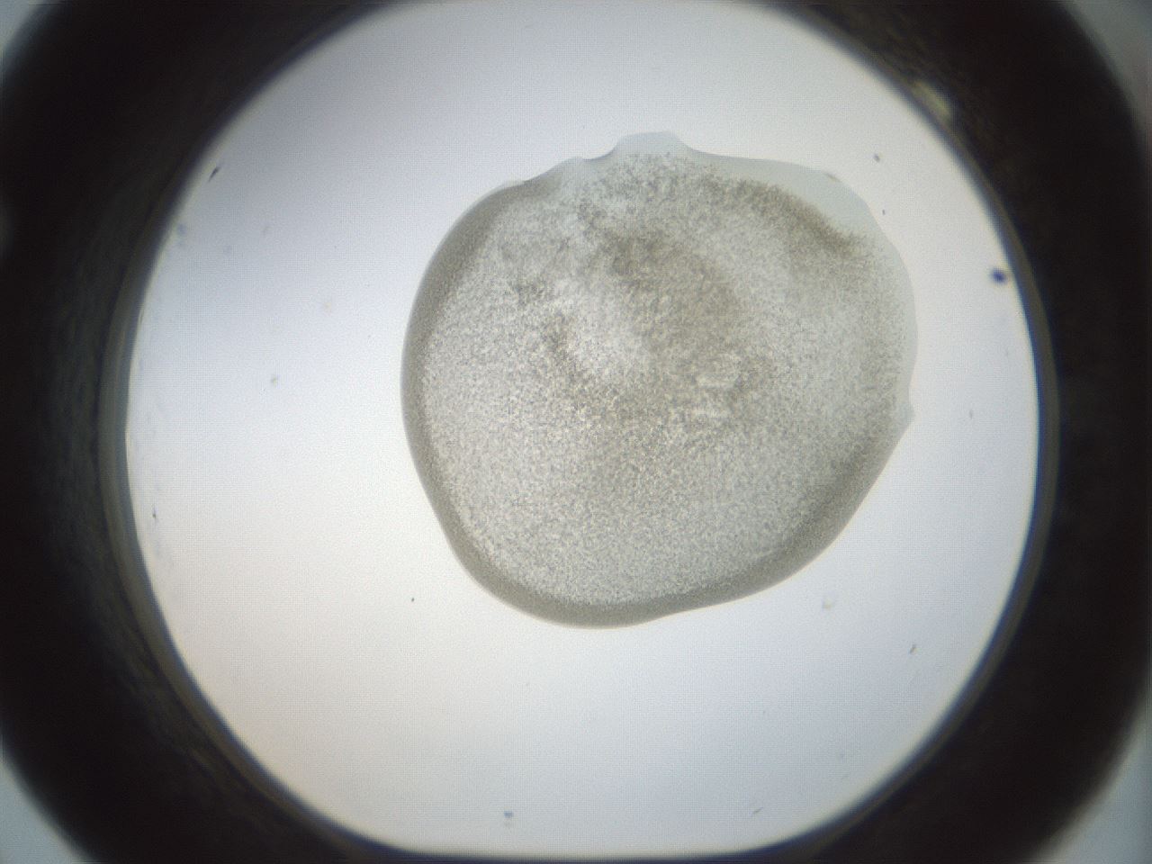 folderID156_plateID1156_batchID3128_wellNum69_profileID1_d1_r63719_ef.jpg