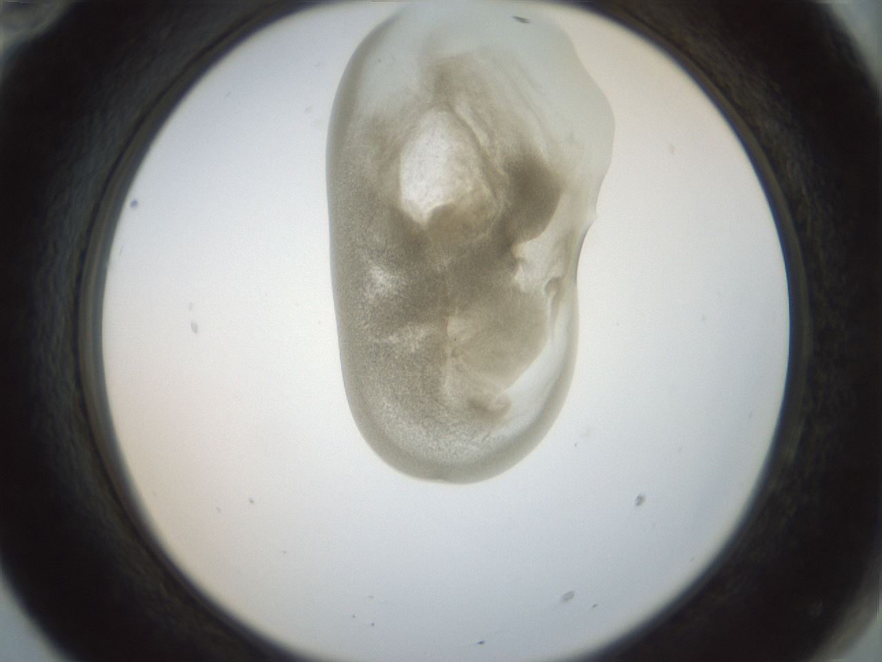 folderID156_plateID1156_batchID3128_wellNum70_profileID1_d2_r63722_ef.jpg