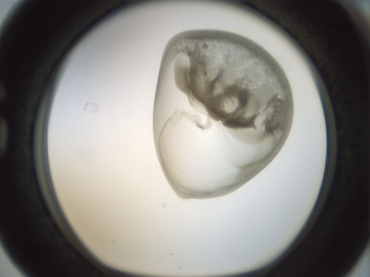 folderID156_plateID1156_batchID3128_wellNum76_profileID1_d1_r63733_ef.jpg