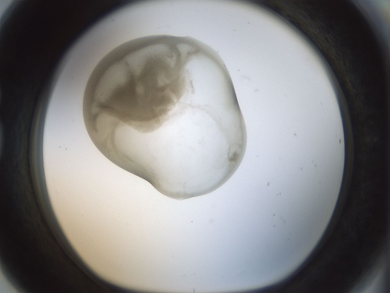 folderID155_plateID1155_batchID3205_wellNum80_profileID1_d1_r62589_ef.jpg