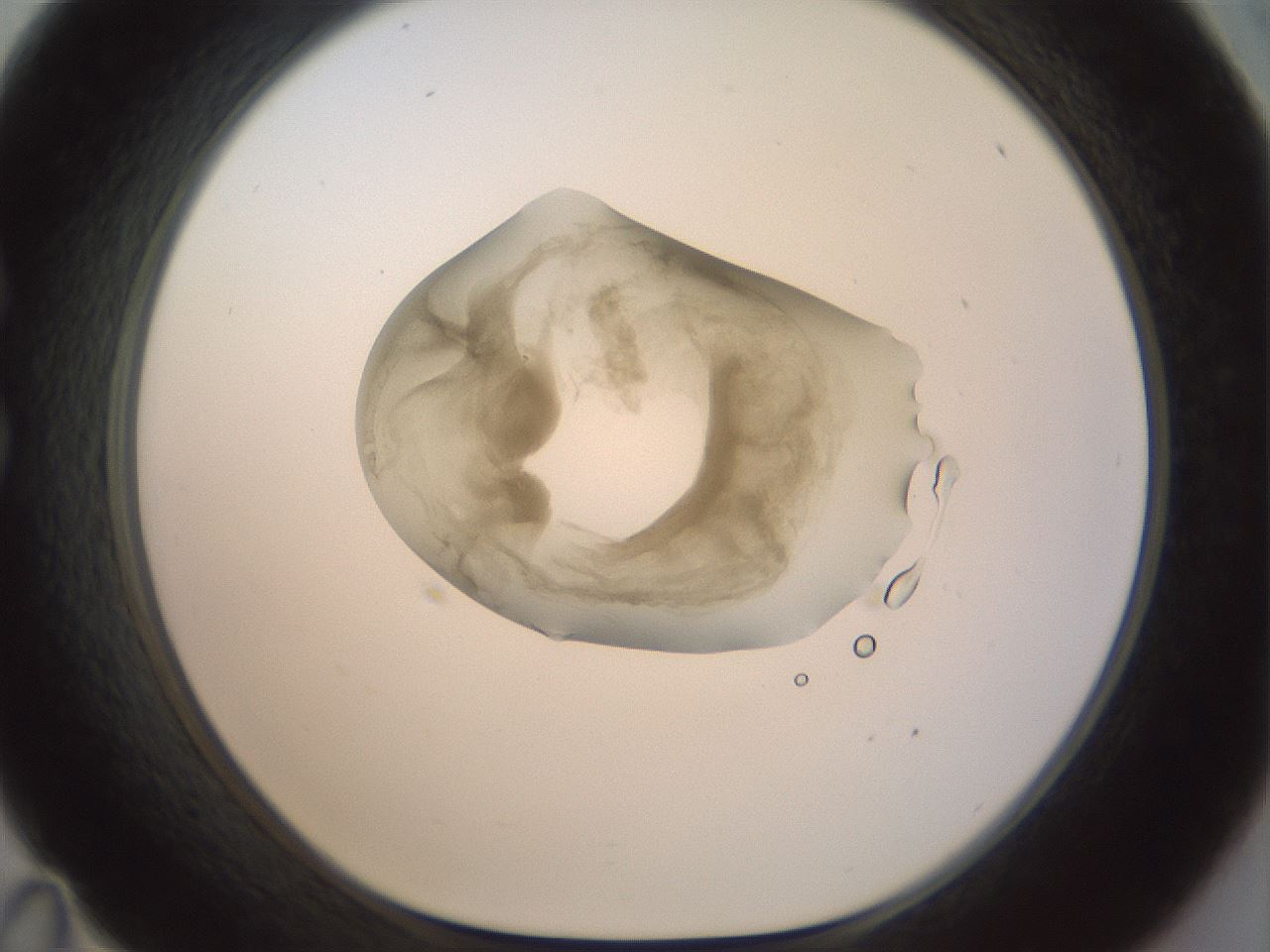 folderID156_plateID1156_batchID3128_wellNum35_profileID1_d1_r63651_ef.jpg