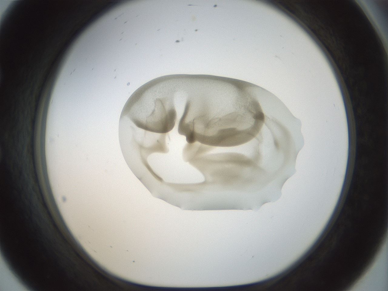folderID156_plateID1156_batchID3128_wellNum56_profileID1_d1_r63693_ef.jpg