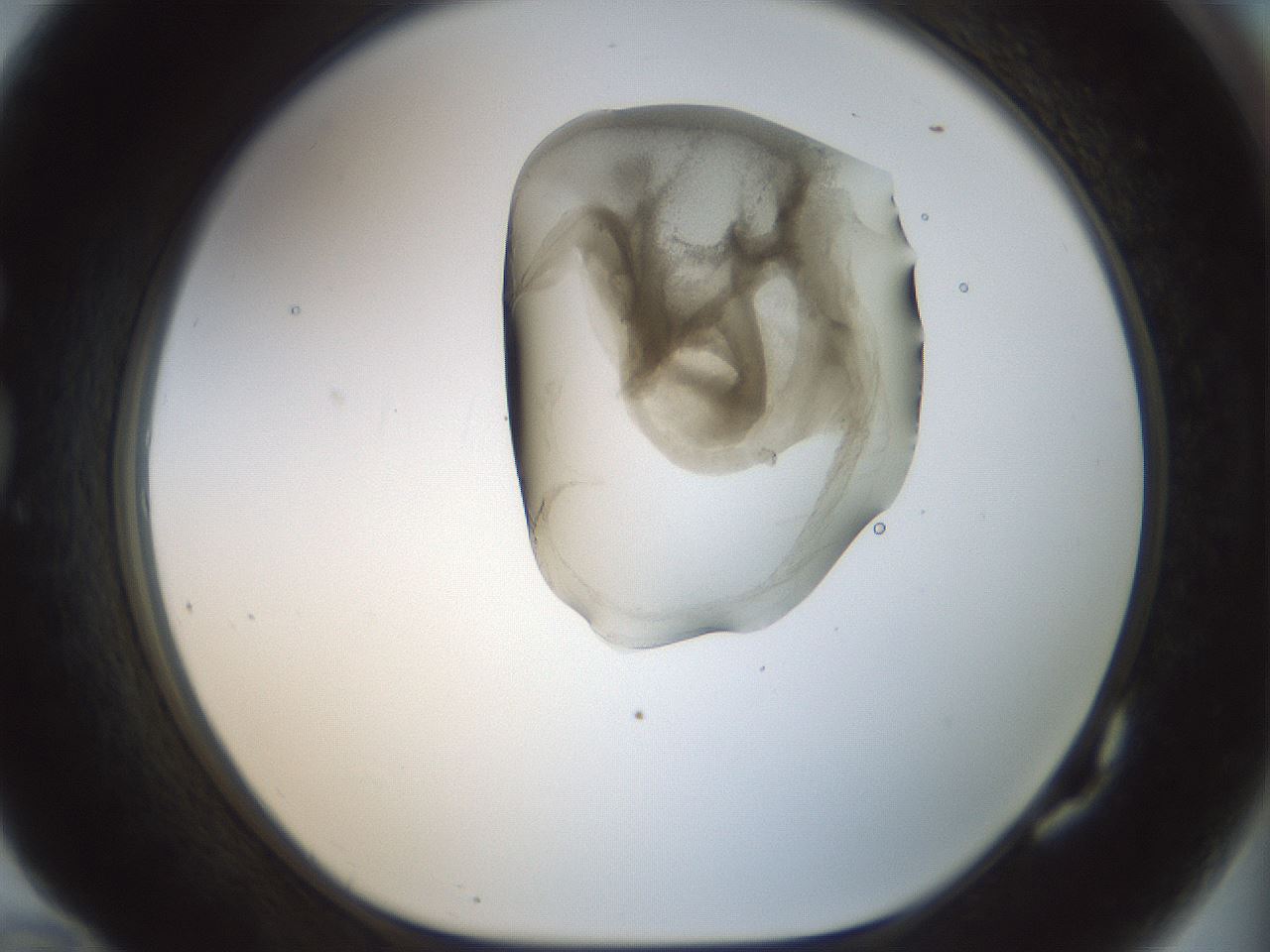 folderID156_plateID1156_batchID3128_wellNum82_profileID1_d1_r63745_ef.jpg