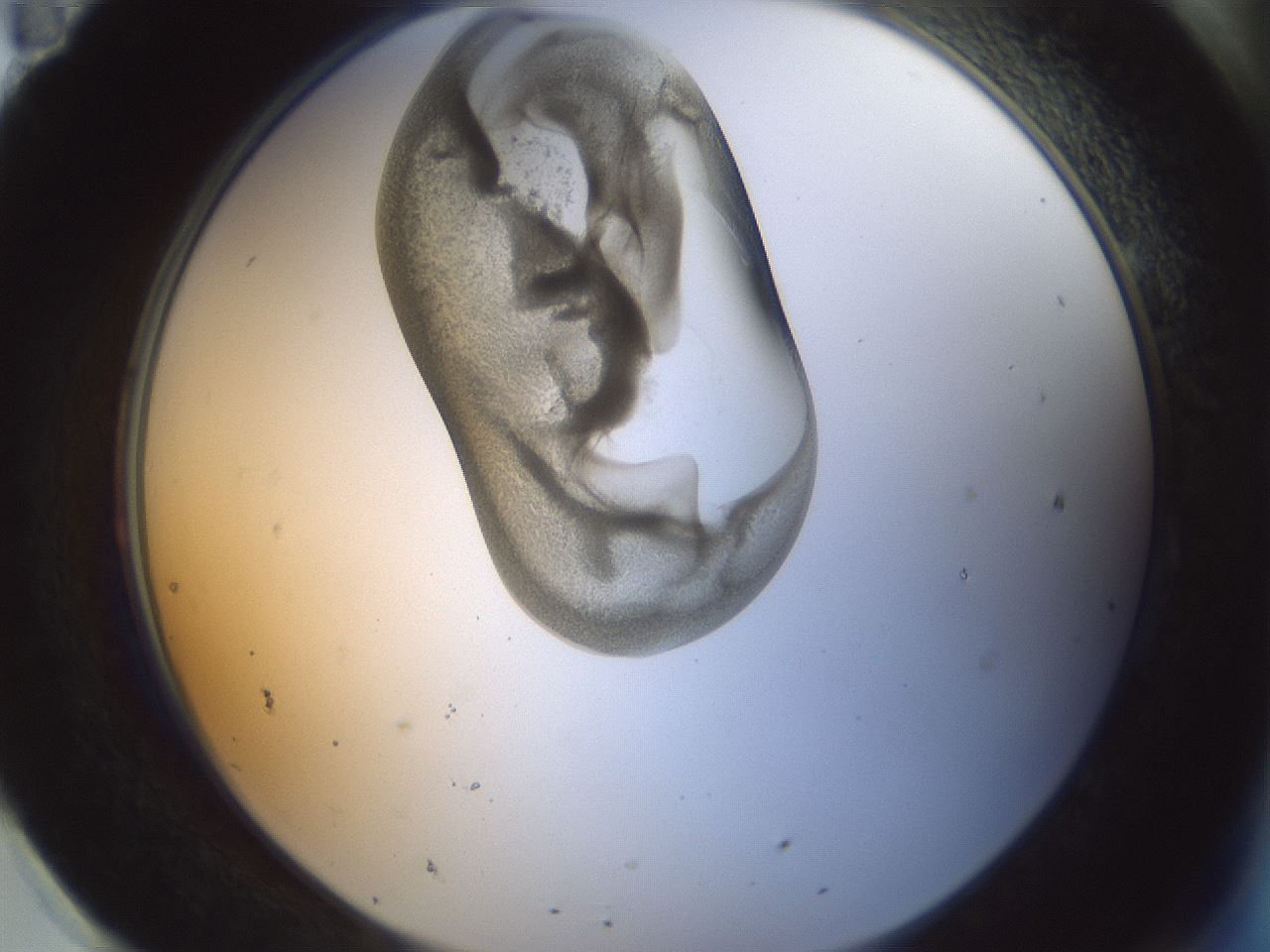 folderID156_plateID1156_batchID3128_wellNum95_profileID1_d2_r63772_ef.jpg