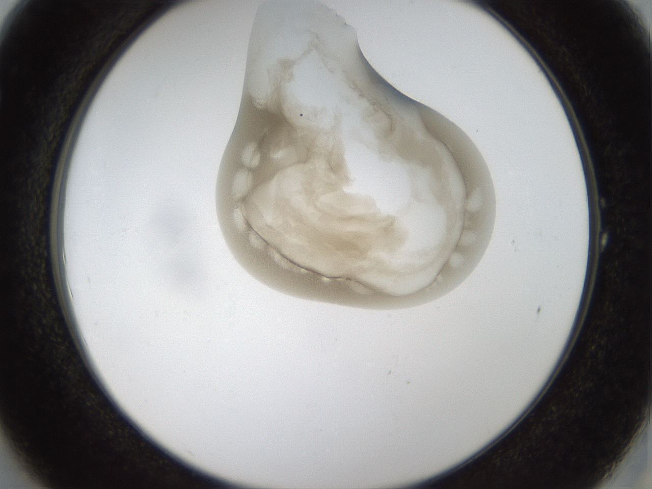 folderID157_plateID1157_batchID3210_wellNum1_profileID1_d2_r63392_ef.jpg
