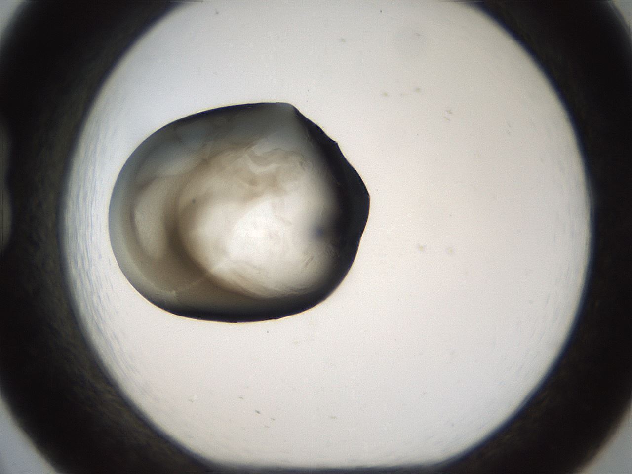 folderID157_plateID1157_batchID3210_wellNum20_profileID1_d1_r63429_ef.jpg