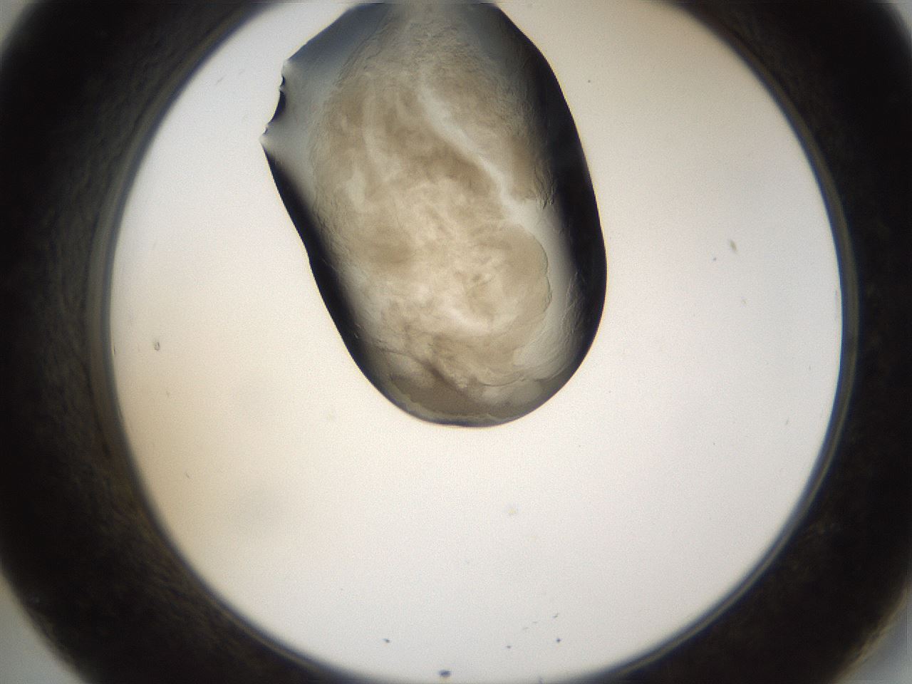 folderID157_plateID1157_batchID3210_wellNum20_profileID1_d2_r63430_ef.jpg