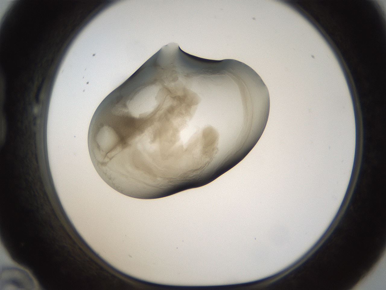 folderID157_plateID1157_batchID3210_wellNum22_profileID1_d1_r63433_ef.jpg