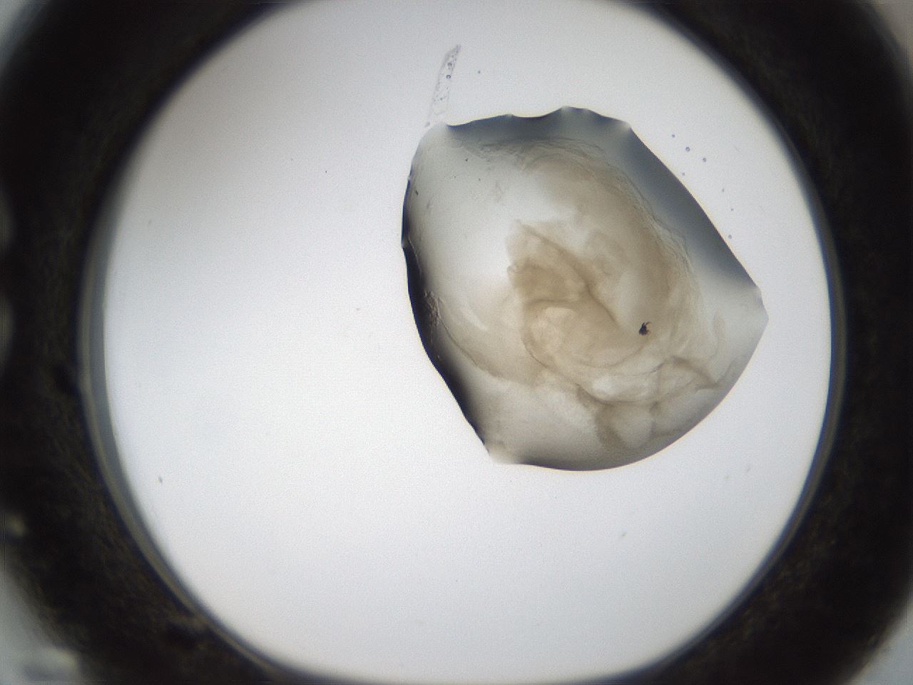 folderID157_plateID1157_batchID3210_wellNum27_profileID1_d1_r63443_ef.jpg