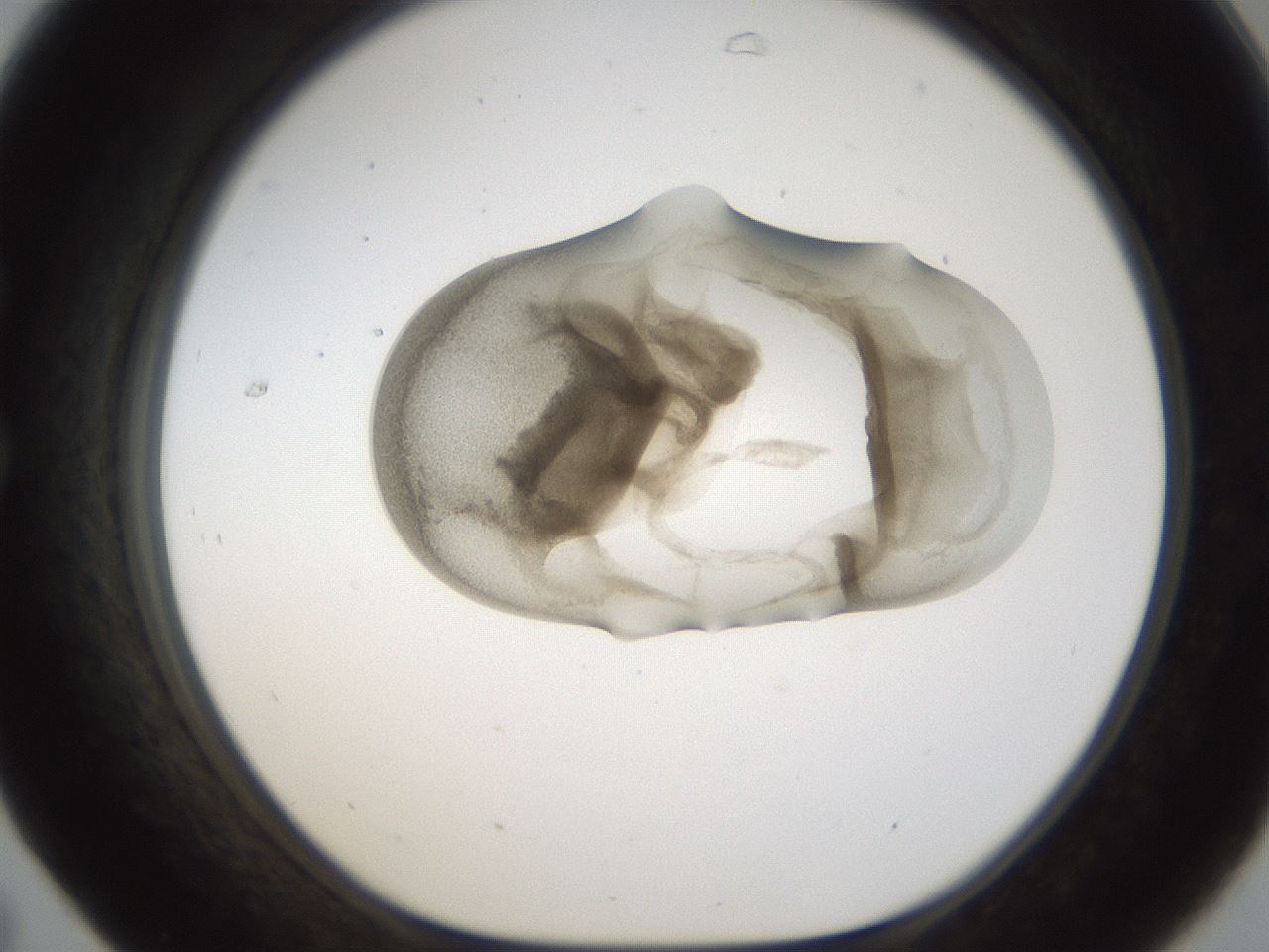 folderID157_plateID1157_batchID3210_wellNum31_profileID1_d1_r63451_ef.jpg