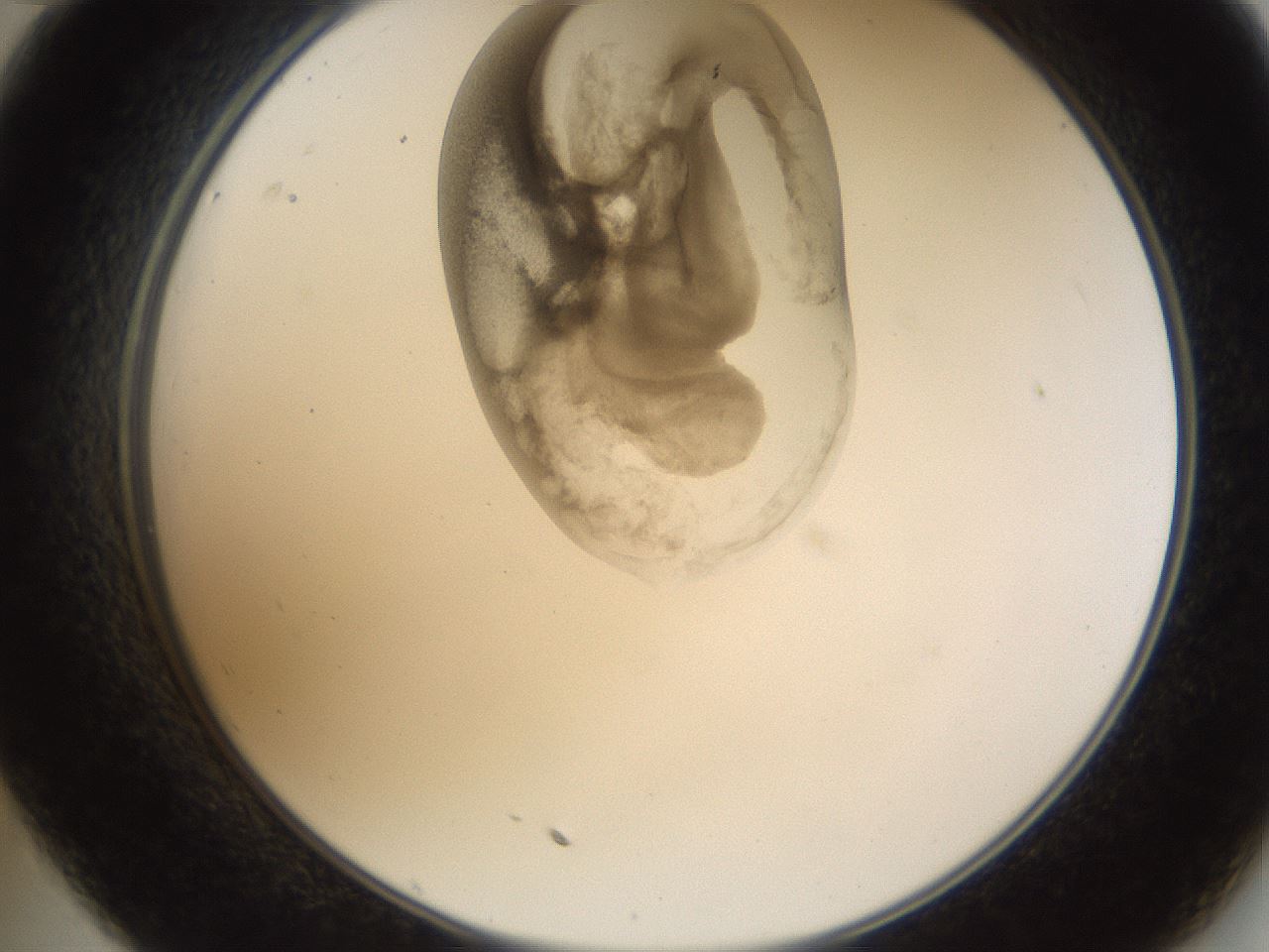 folderID157_plateID1157_batchID3210_wellNum35_profileID1_d2_r63460_ef.jpg