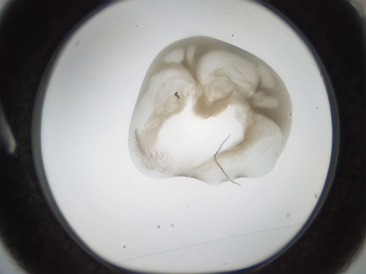 folderID157_plateID1157_batchID3210_wellNum3_profileID1_d1_r63395_ef.jpg