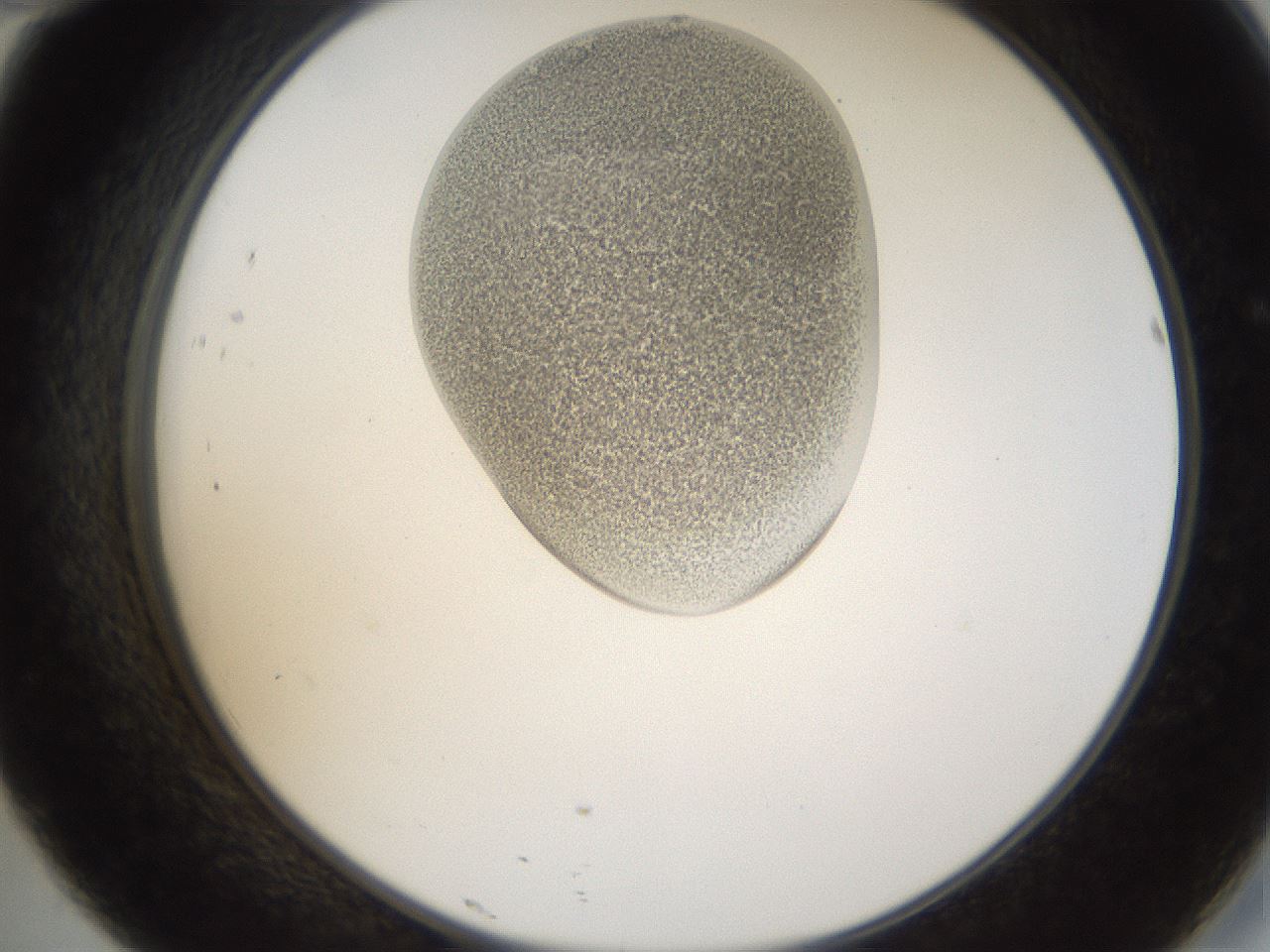folderID157_plateID1157_batchID3210_wellNum46_profileID1_d2_r63482_ef.jpg