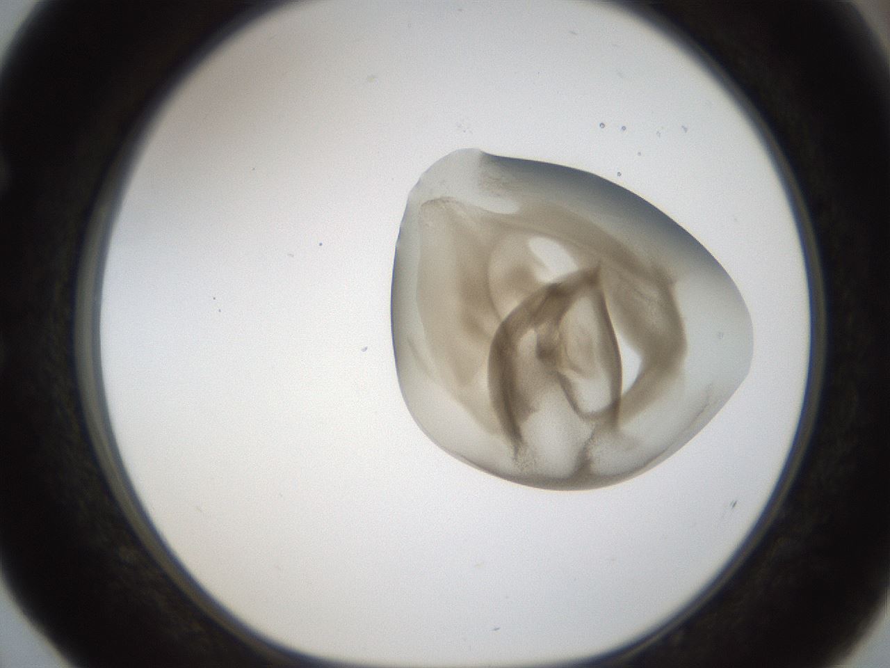 folderID157_plateID1157_batchID3210_wellNum52_profileID1_d1_r63493_ef.jpg