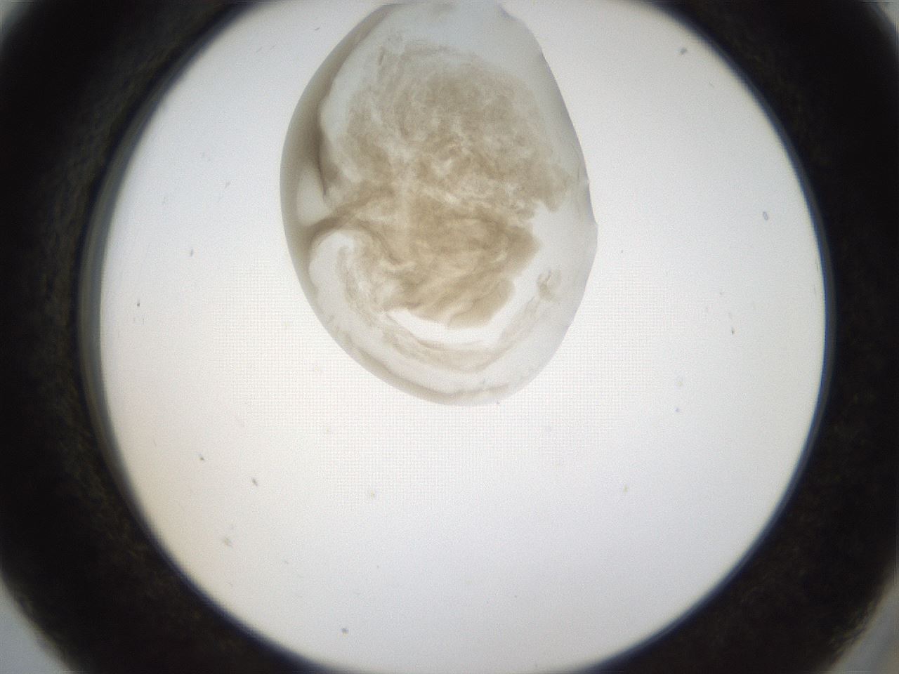 folderID157_plateID1157_batchID3210_wellNum5_profileID1_d2_r63400_ef.jpg