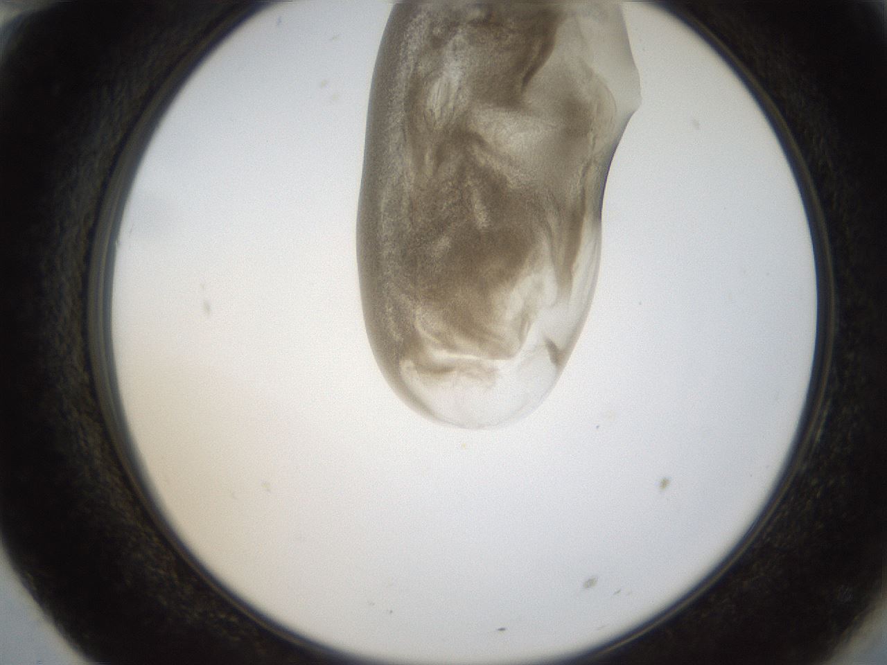 folderID157_plateID1157_batchID3210_wellNum70_profileID1_d2_r63530_ef.jpg