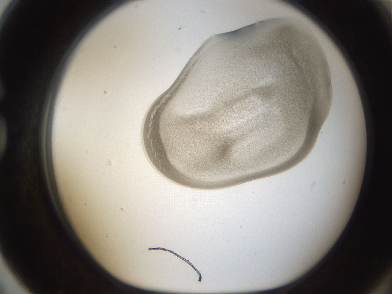 folderID157_plateID1157_batchID3210_wellNum79_profileID1_d1_r63547_ef.jpg
