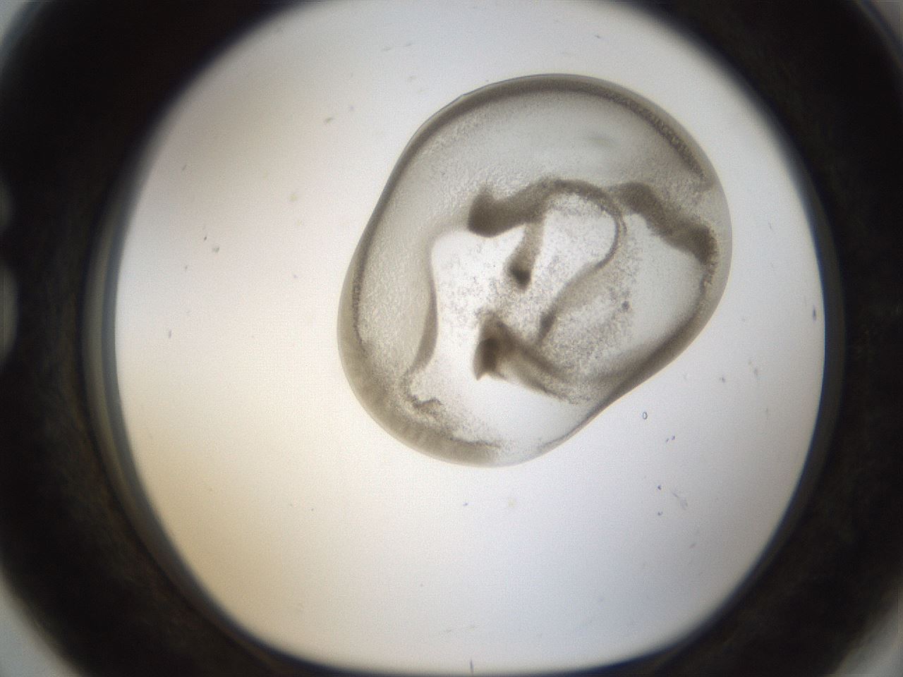 folderID157_plateID1157_batchID3210_wellNum80_profileID1_d1_r63549_ef.jpg